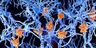 Revival of Riverland MS group post image