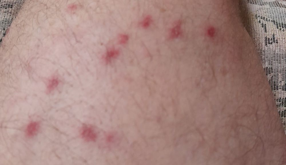 Stinging reminder to bee very careful post image