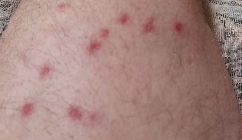 Stinging reminder to bee very careful post image