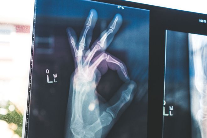 Image of: Apple Health Will Follow ApplePay