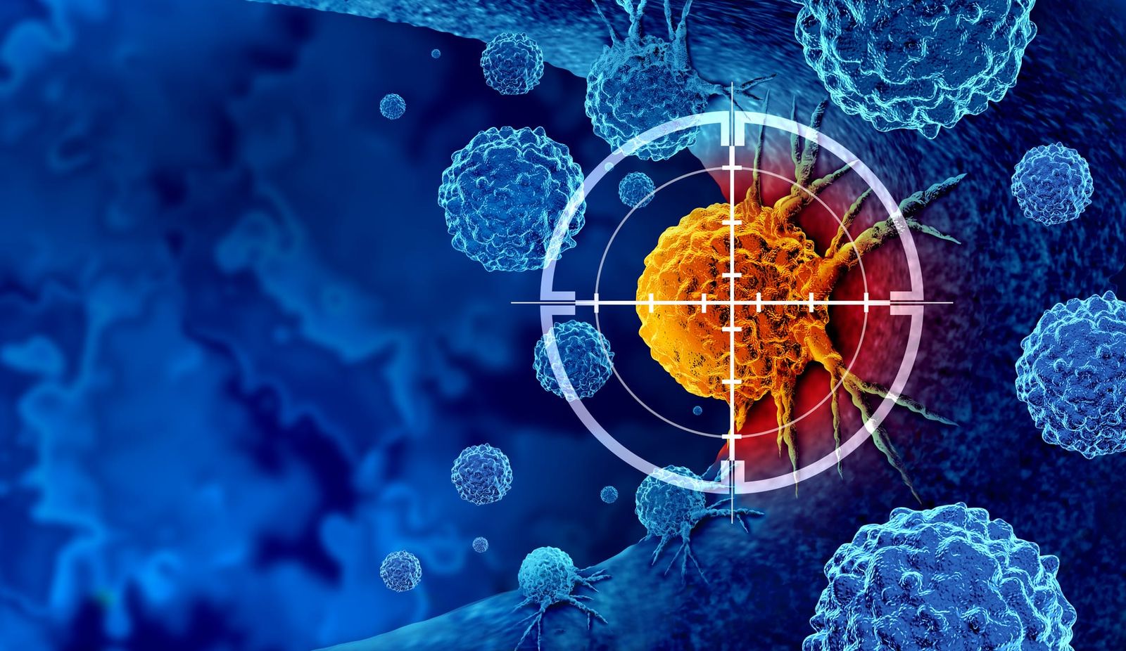 The Bad News: It’s (National) Cancer. But it Can Be Contained.