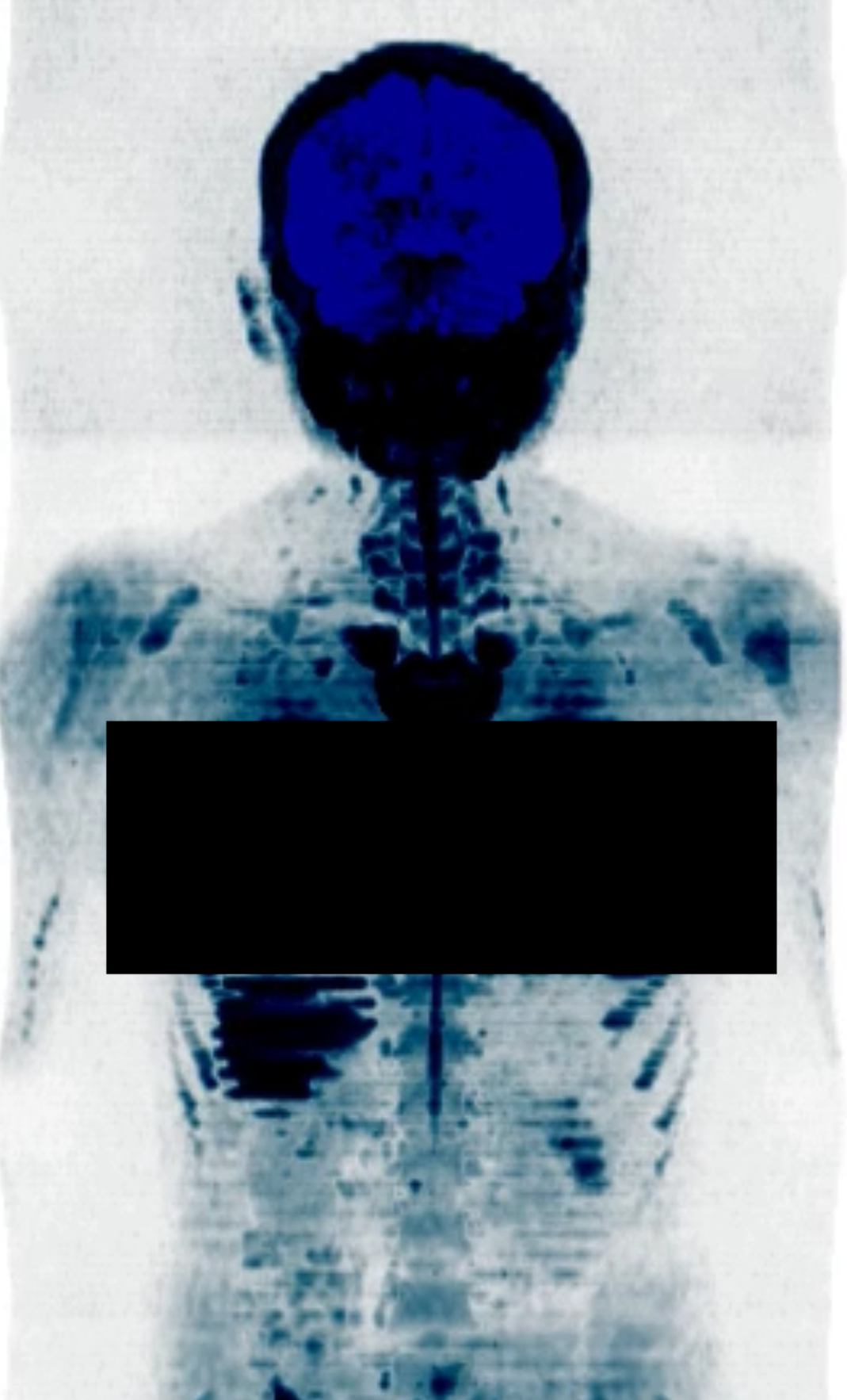 Experiencing a Prenuvo full-body MRI