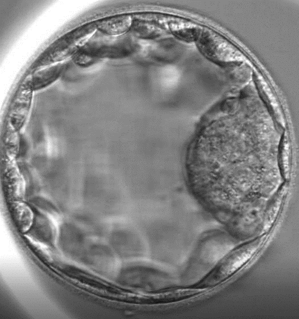 Donating my eggs in my 30s