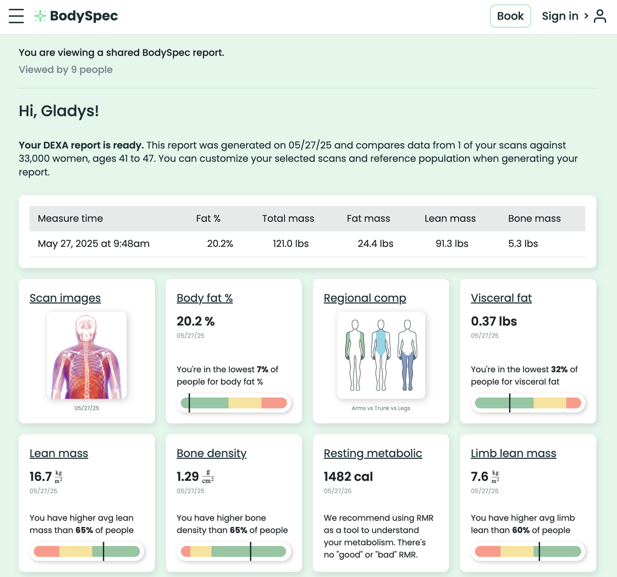 Getting my first DEXA scan