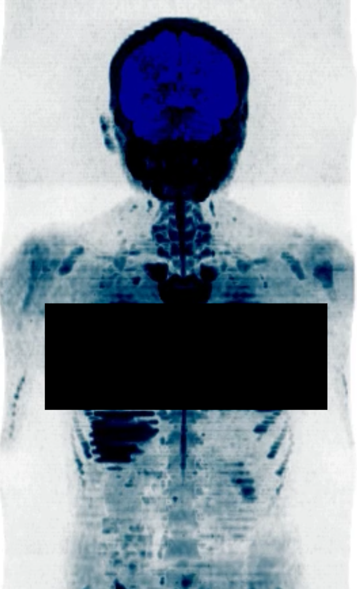 Experiencing a Prenuvo full-body MRI