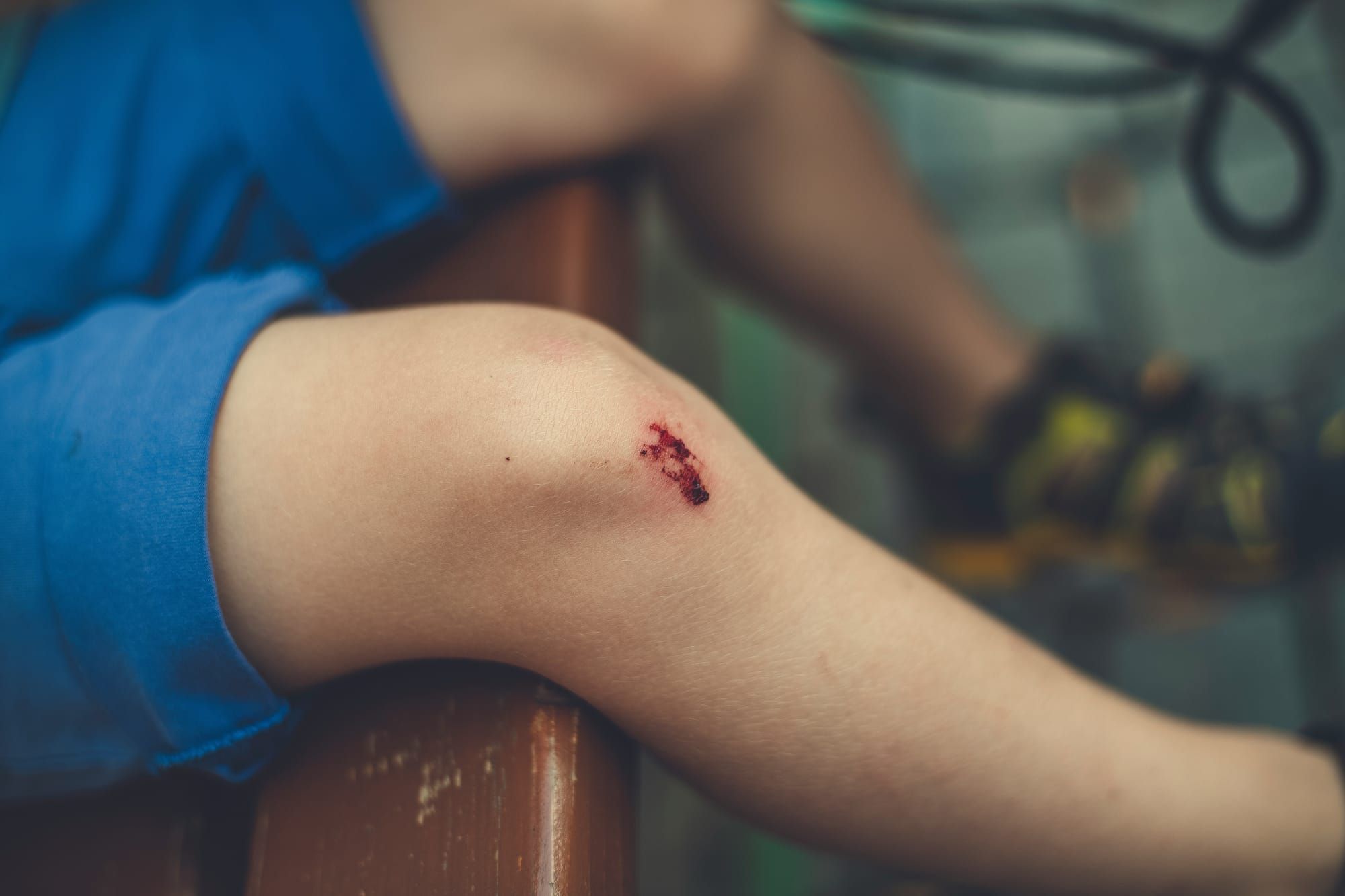 Overcoming the Mental Challenges of Injuries