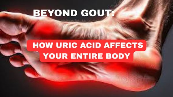 Beyond Gout: How Uric Acid Affects Your Entire Body