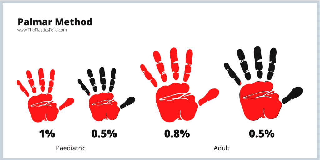 The Palmar Method use to calculate the total body surface area percentage of a burn