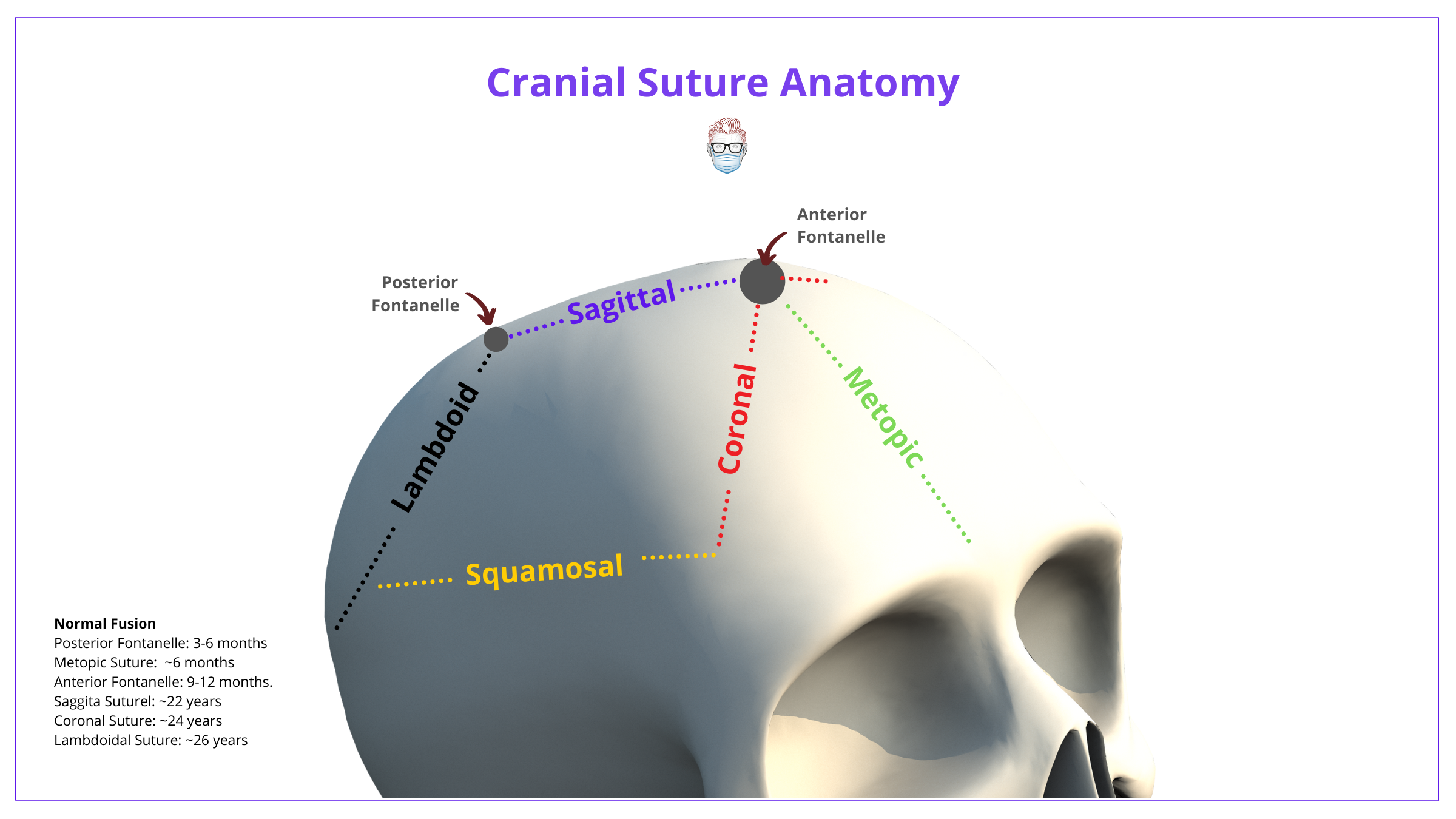 Cranial Sutures, Skull Anatomy, Anatomy, Skull, Sutures, Fontanelles, Metopic Suture, Coronal Suture, Saggital Suture, Squamosal Suture, Lambdoidal Suture, Posterior Fontanelle, Anterior Fontanelle