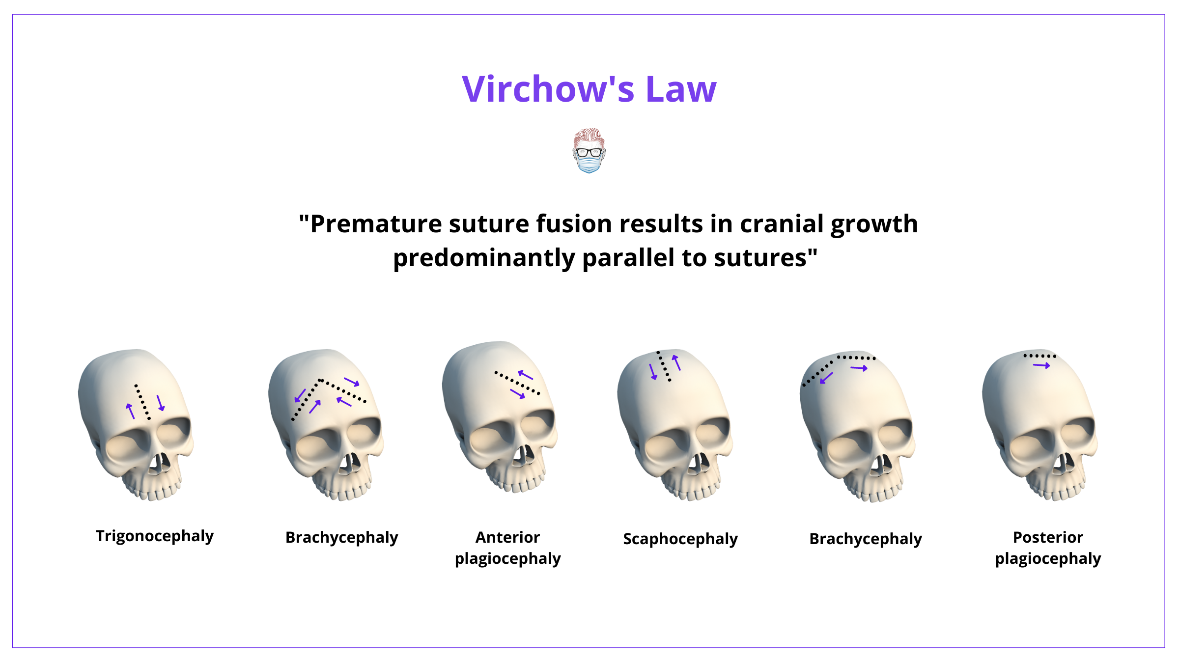 Virchow's Law for Craniosynostosis, Virchow's Law, Craniosynostosis