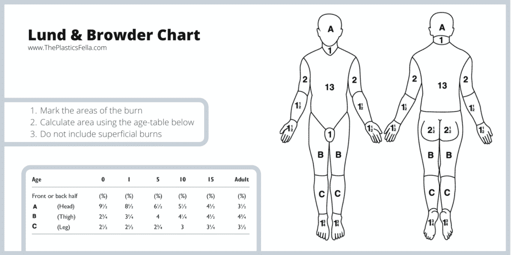 Lund & Browder Chart for classifying burns, Fluid Resuscitation in Burns