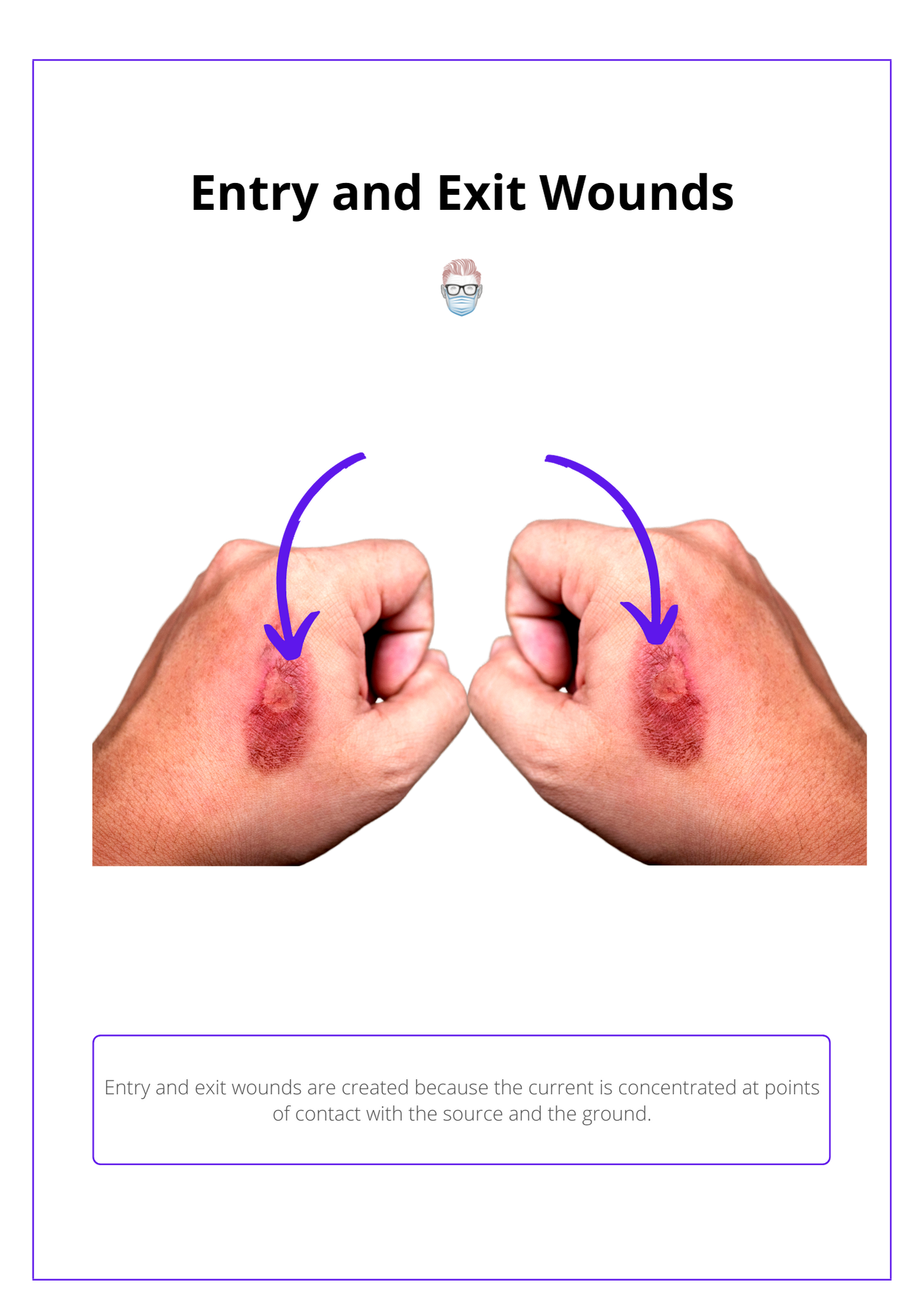 Exit and Entry Points of an Electrical Burn