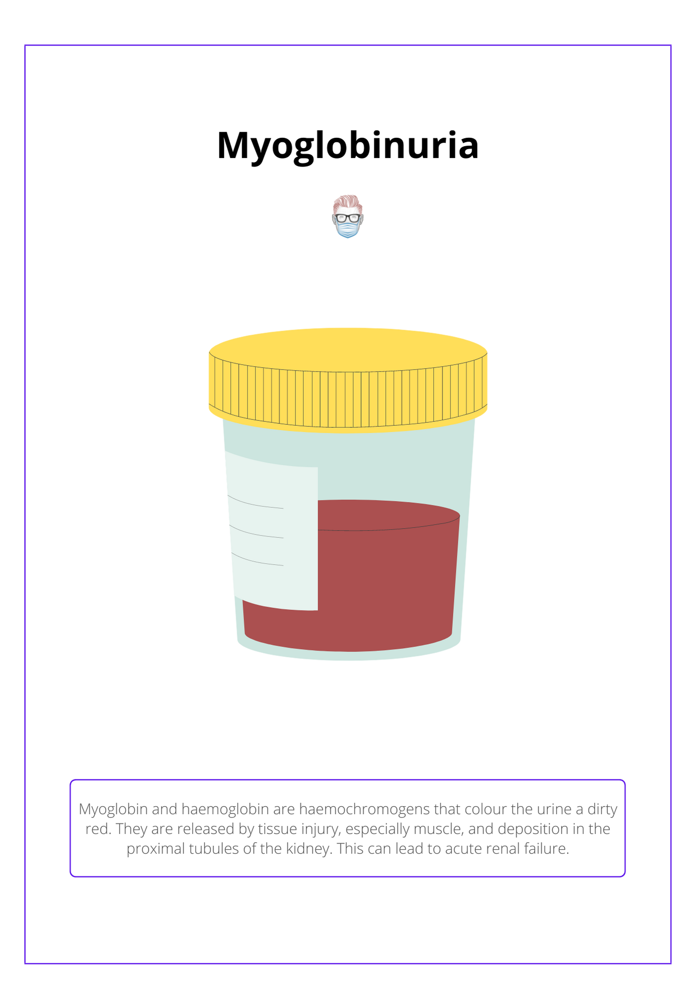 Myoglobinuria, Electrical burn characteristics, renal failure
