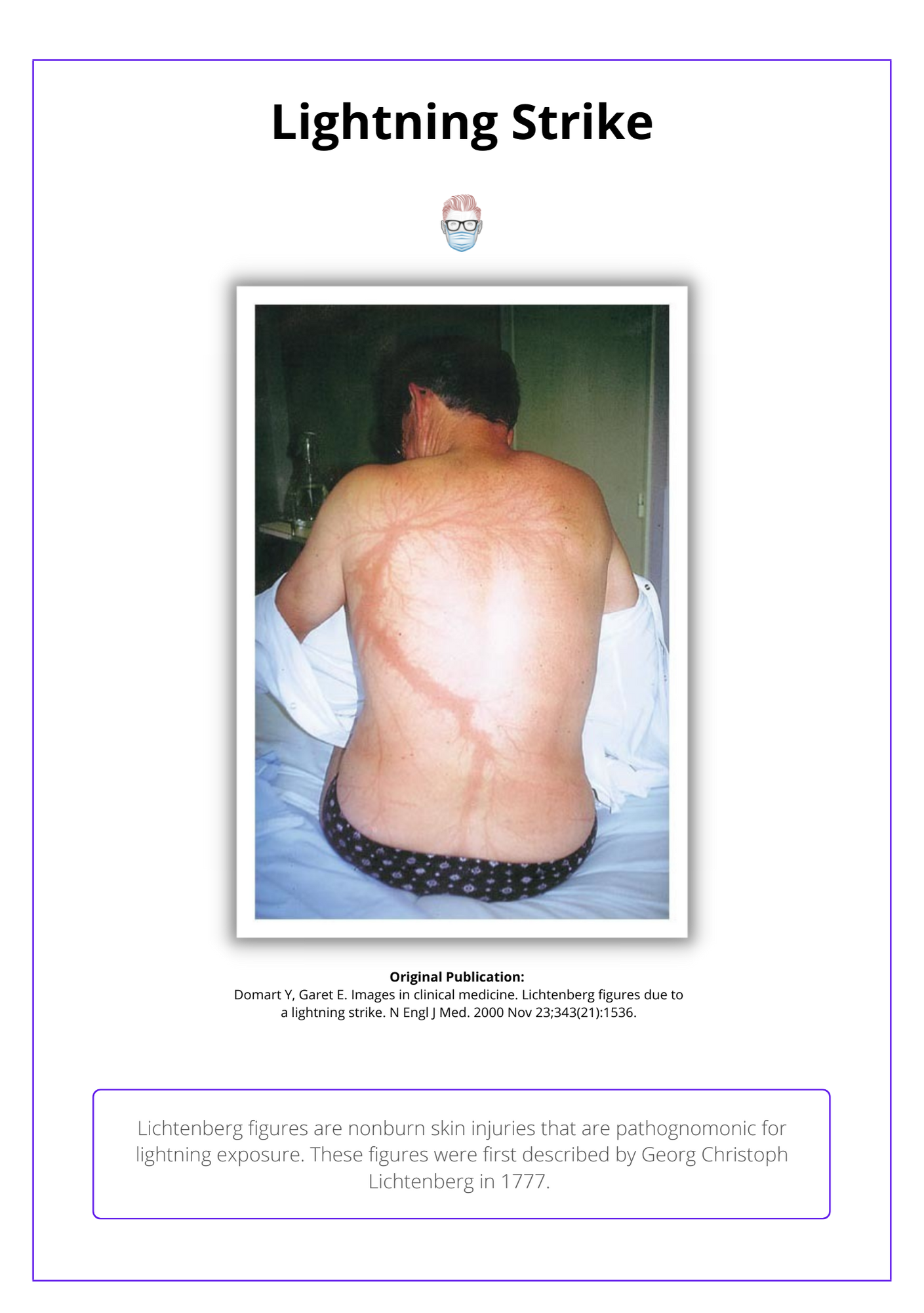 Lightning Strike, electrical burn injuries