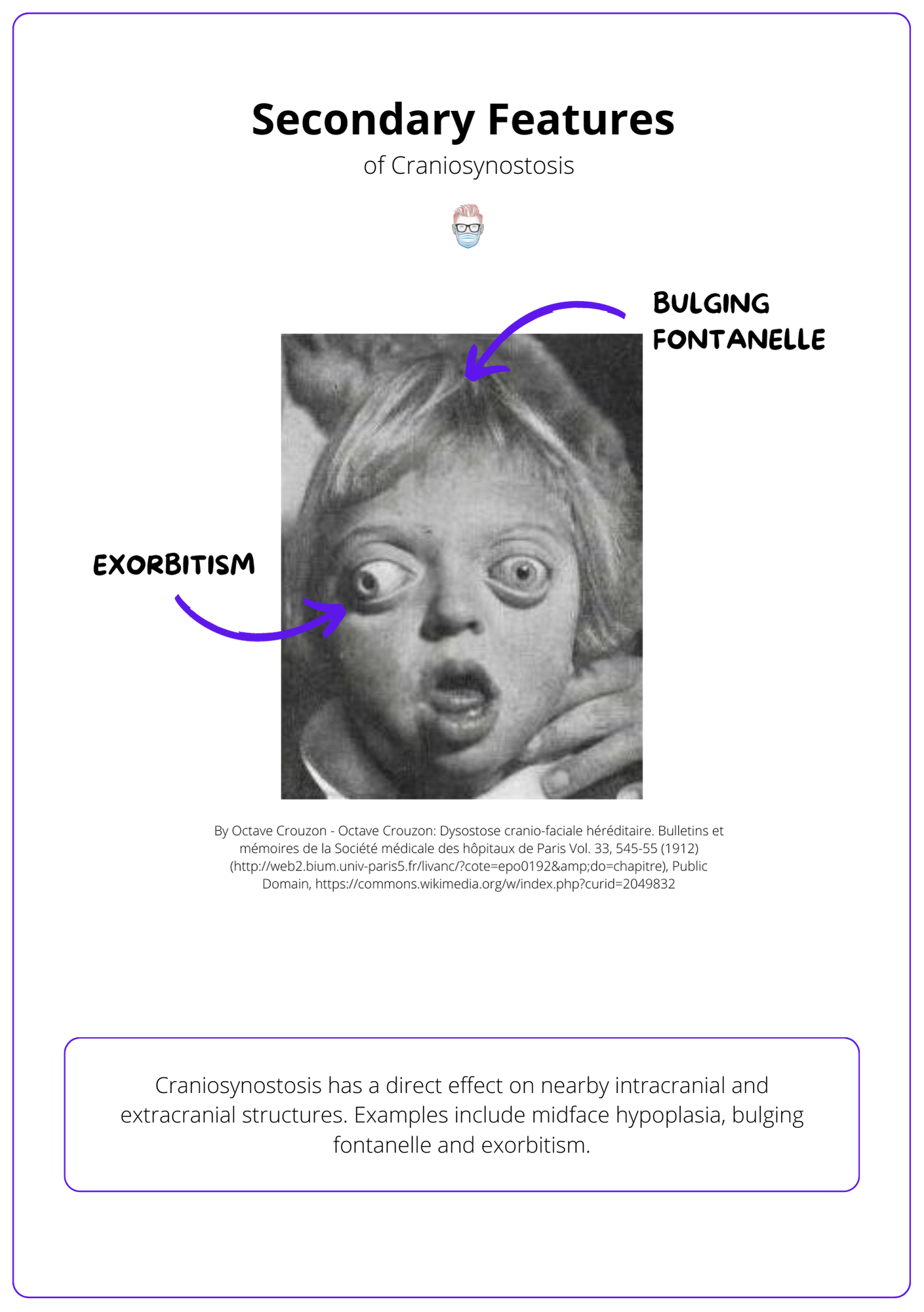 Secondary Features of Craniosynostosis, Craniosynostosis Diagnosis