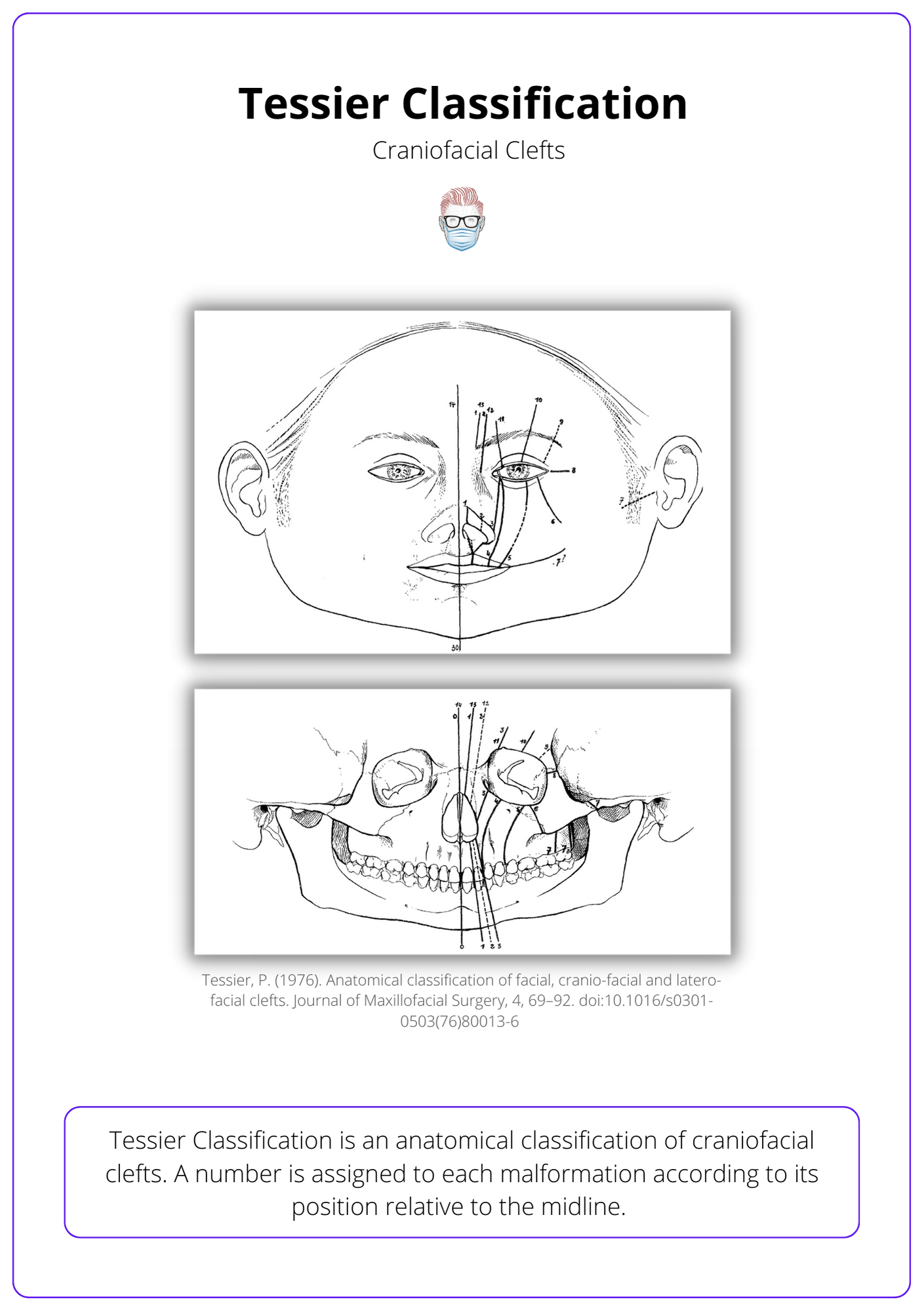 Tessier Classification for Craniofacial Clefts