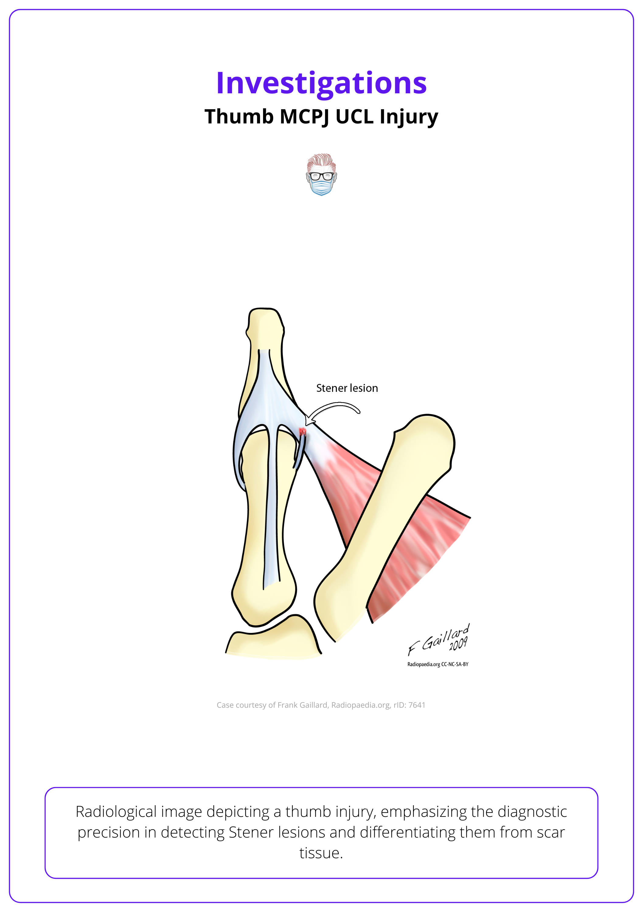 Investigations for Thumb MCPJ UCL Injury, Thumb MCPJ UCL Injury Anatomy