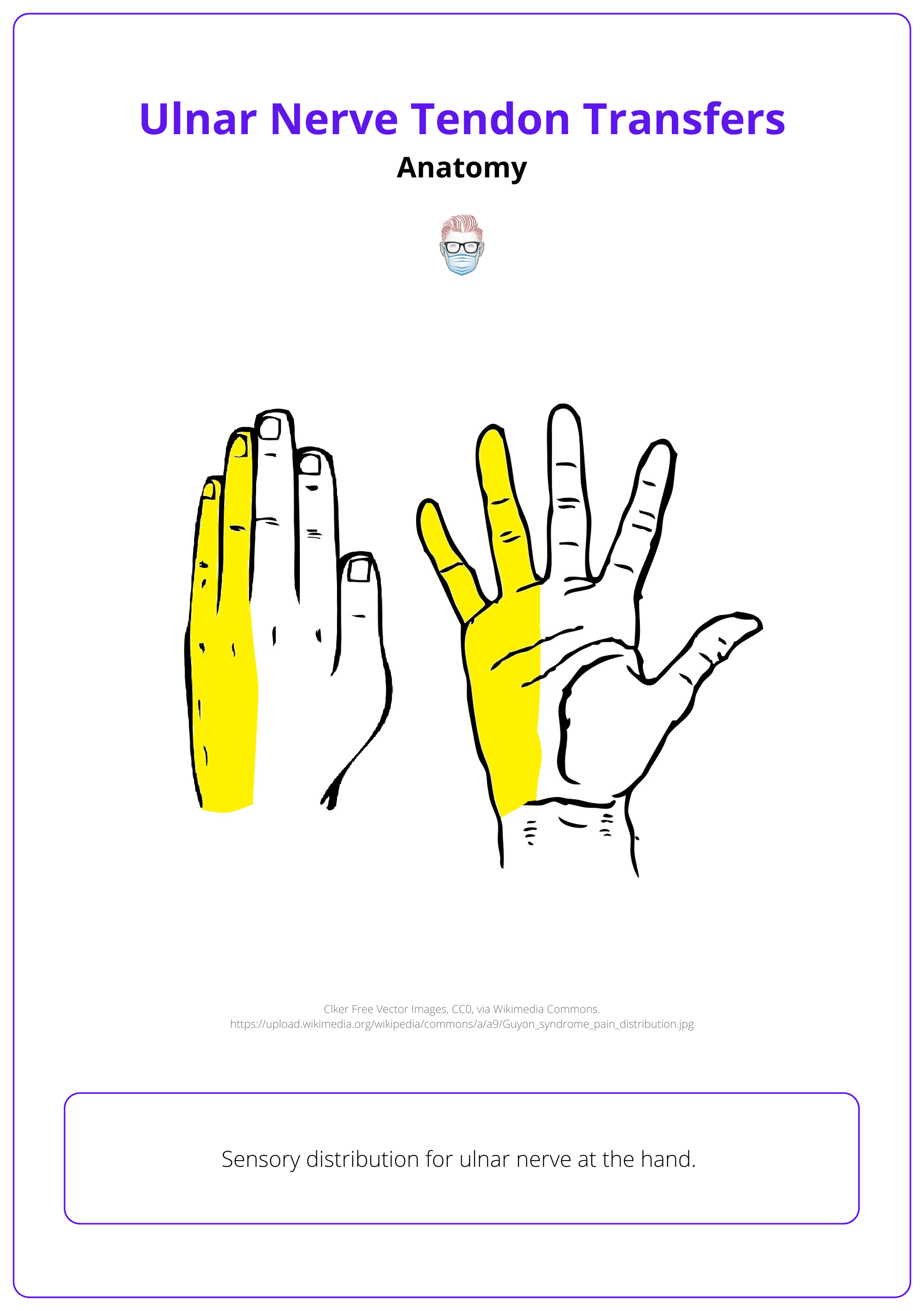 Sensory distribution of the ulnar nerve.