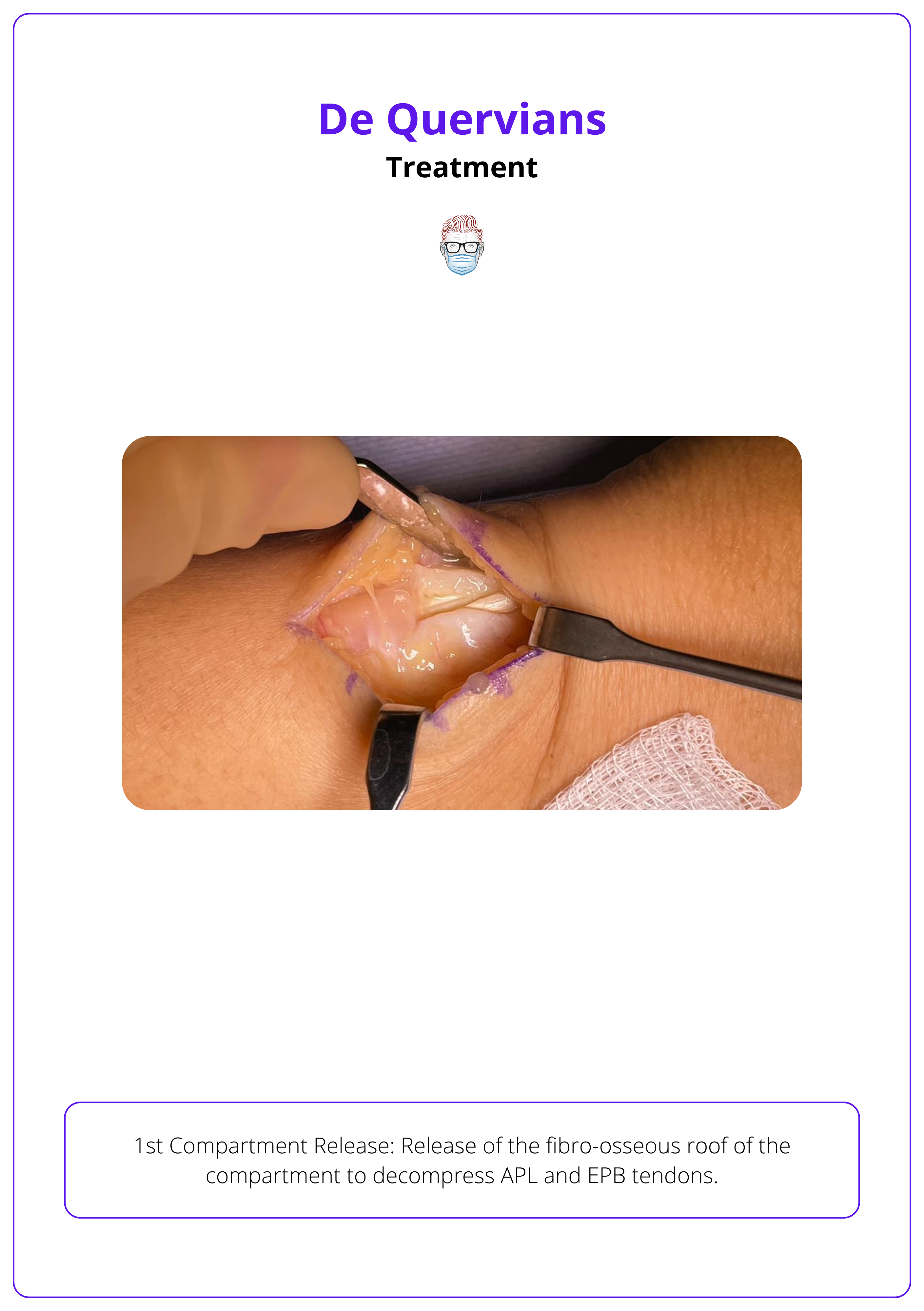 Surgical release to decompress APL and EPB tendons in De Quervians