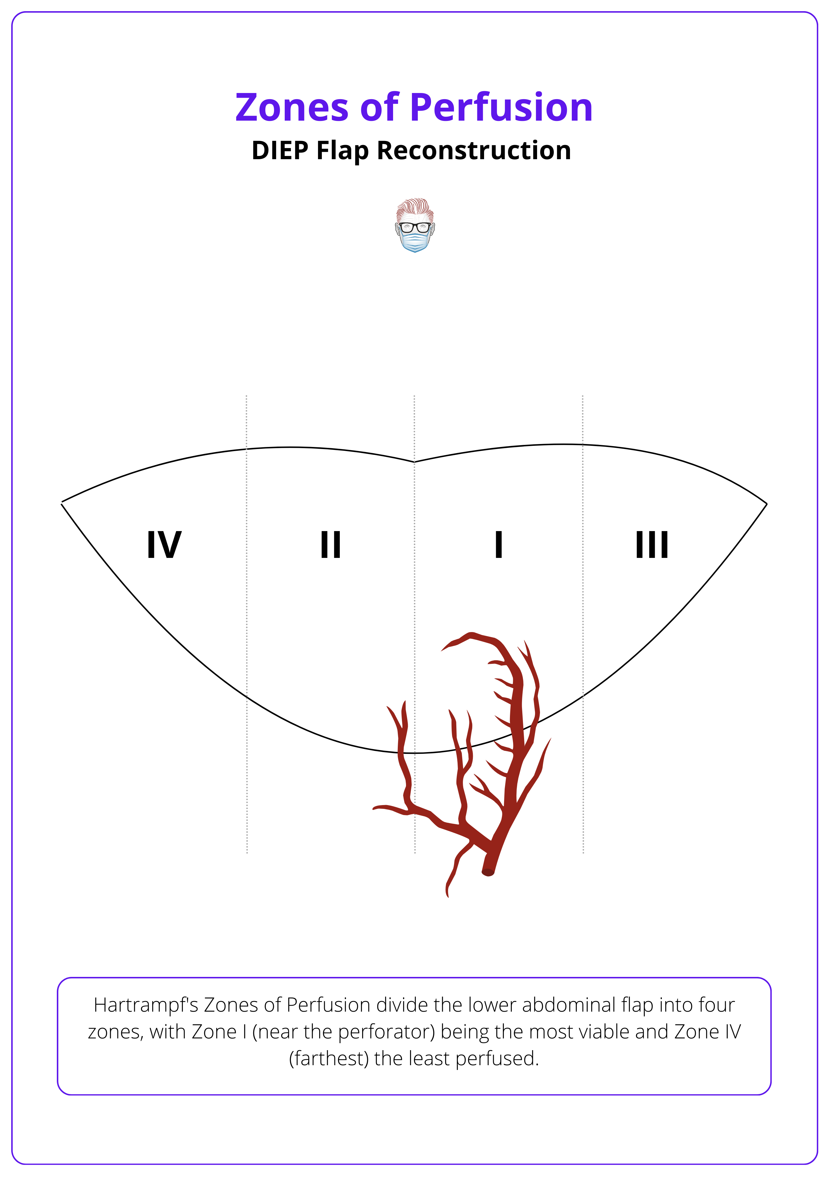 Four vascular zones described by Hartrampf