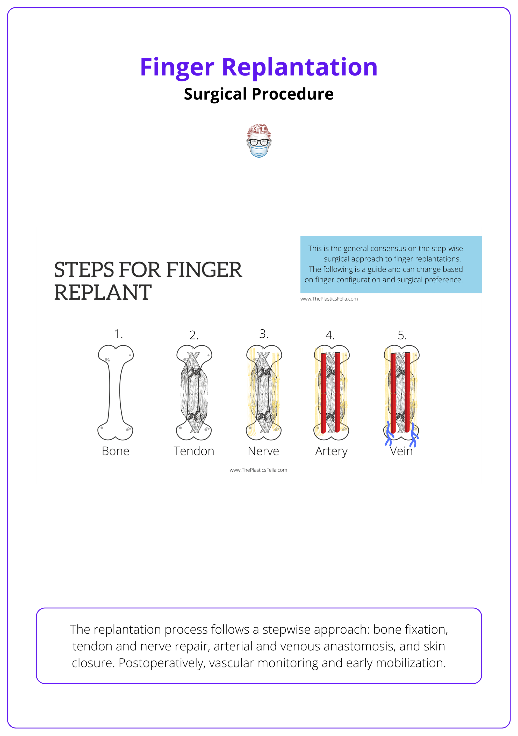How to replant a finger amputation