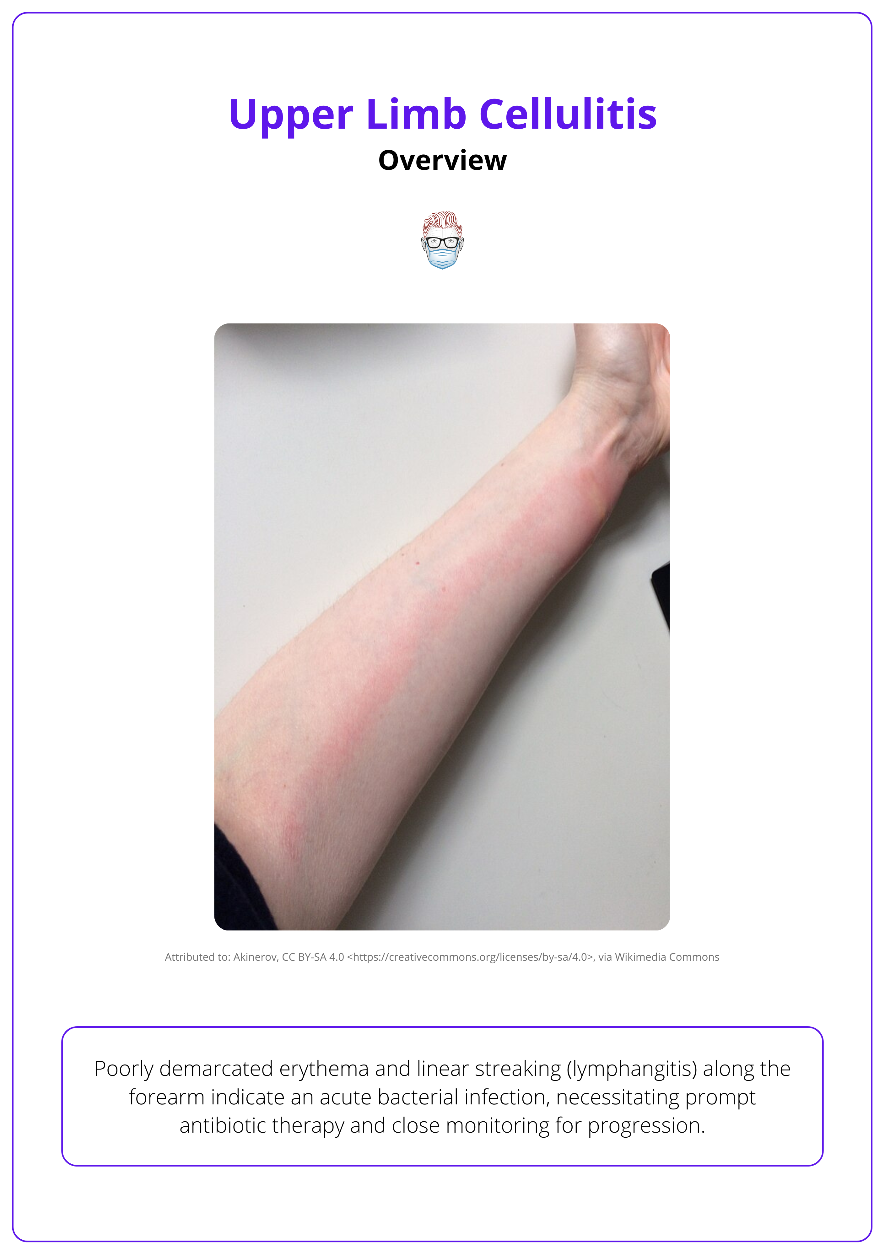 Presentation of upper limb cellulitis