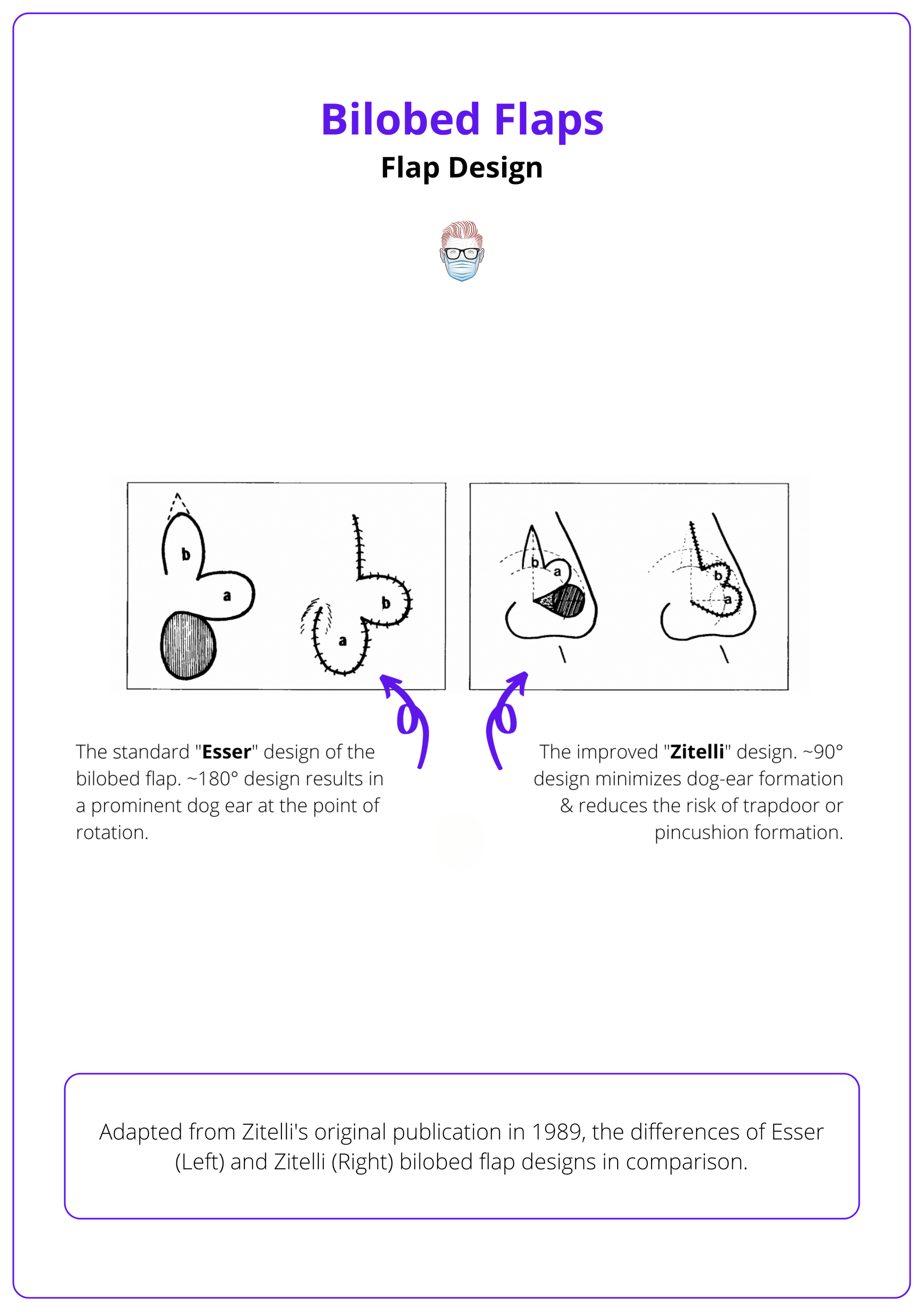 Comparison of the Esser (Left) and Zitelli (Right) bilobed flap designs