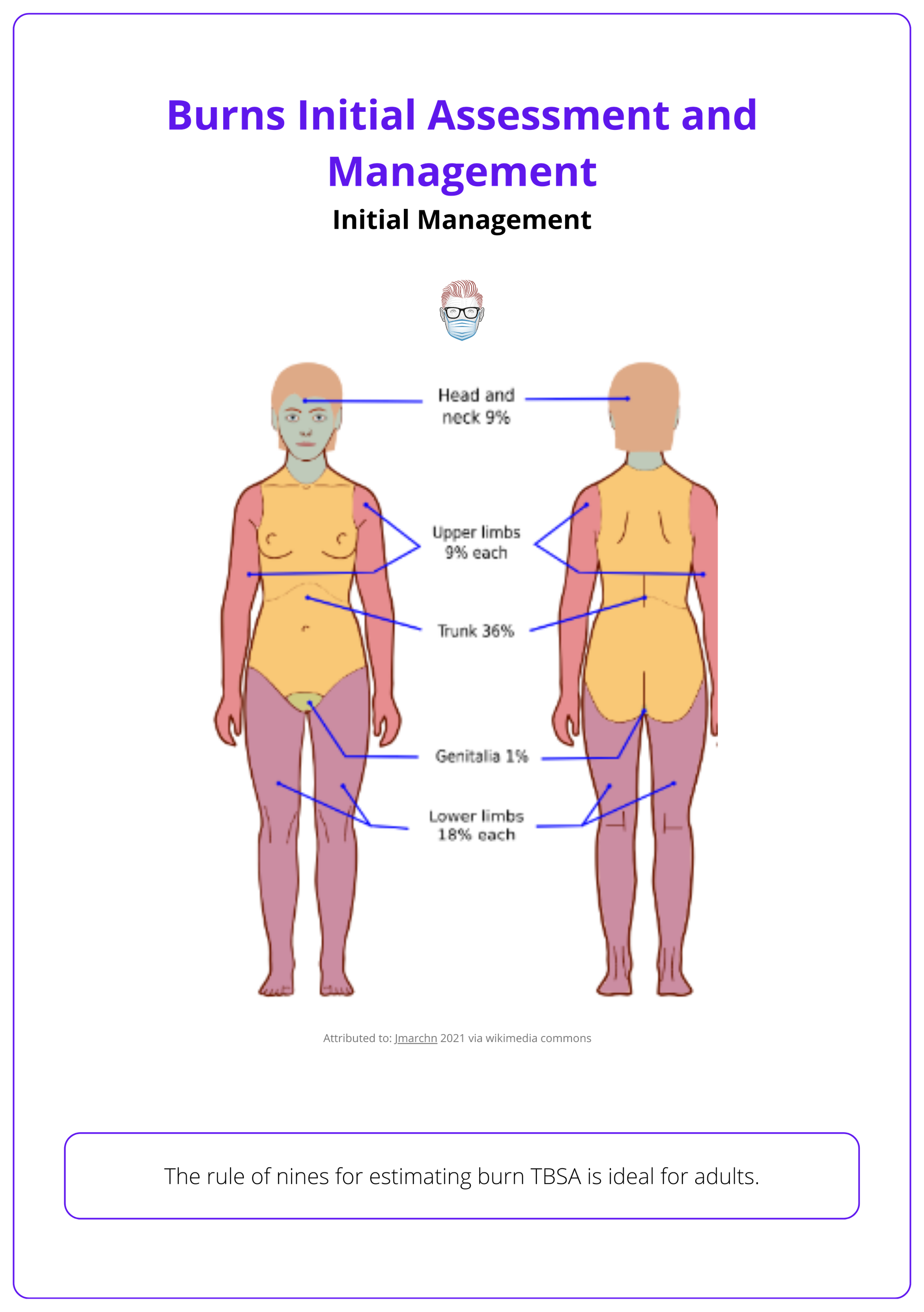 Rule of nines for estimating TBSA, burn management