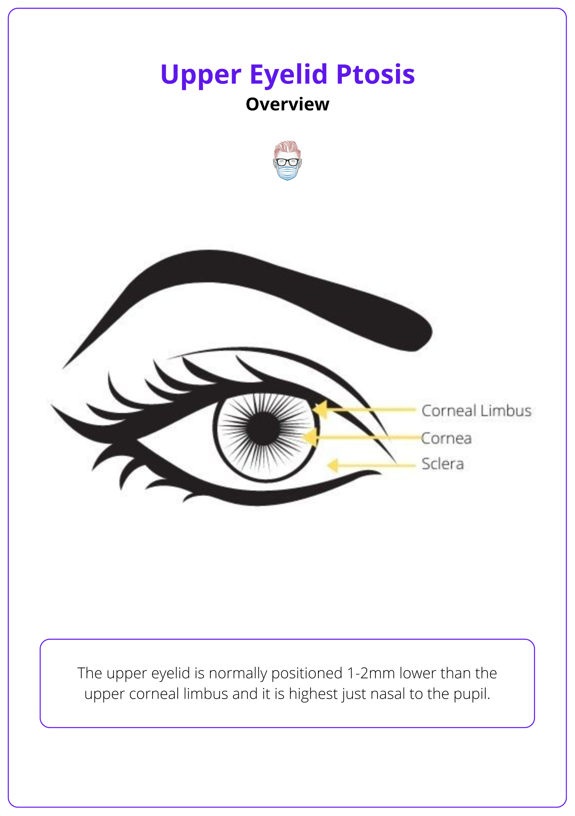 Corneal limbus is the border between the cornea and the sclera