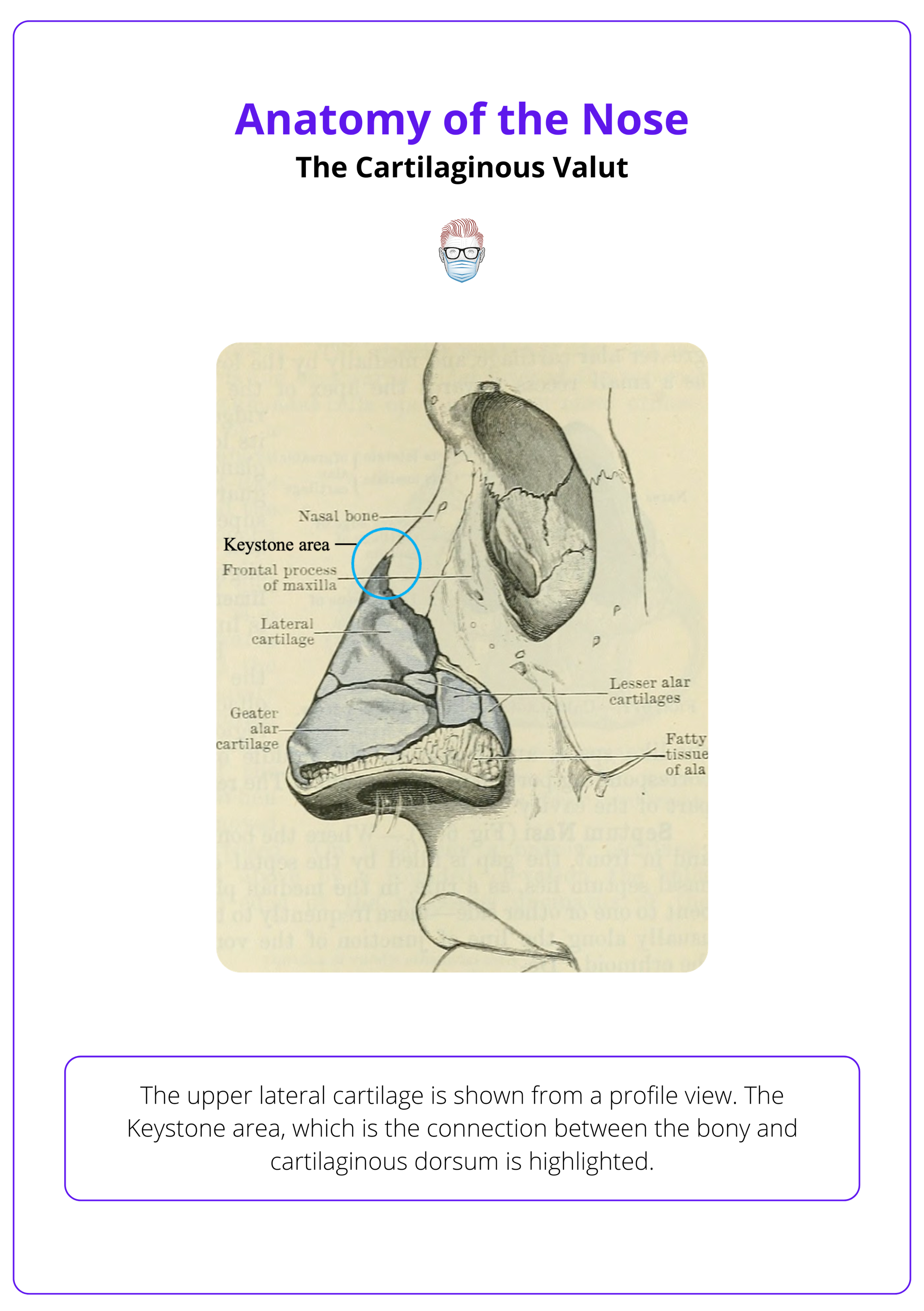 Middle 1/3 cartilaginous vault of the nose
