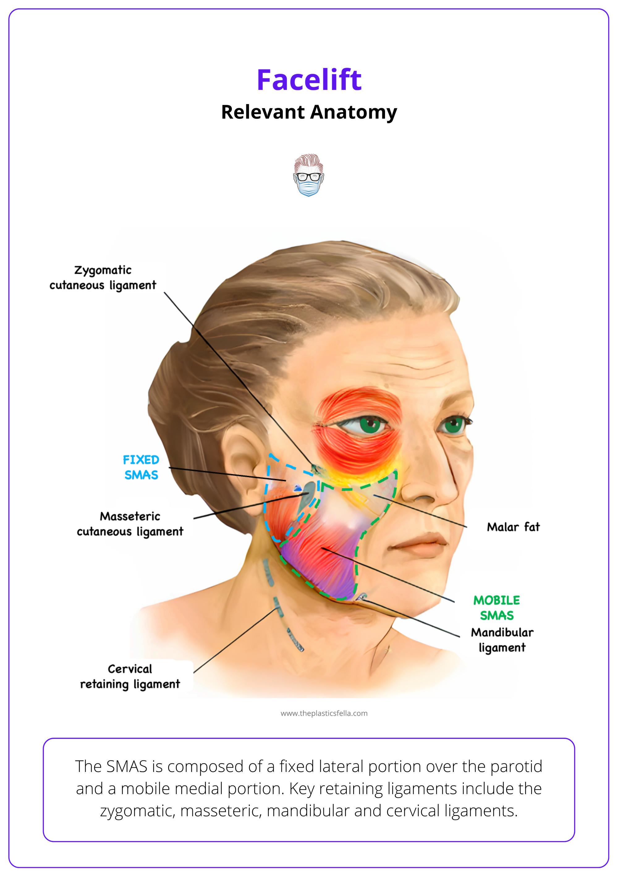 SMAS layers of the face, Facelift surgery