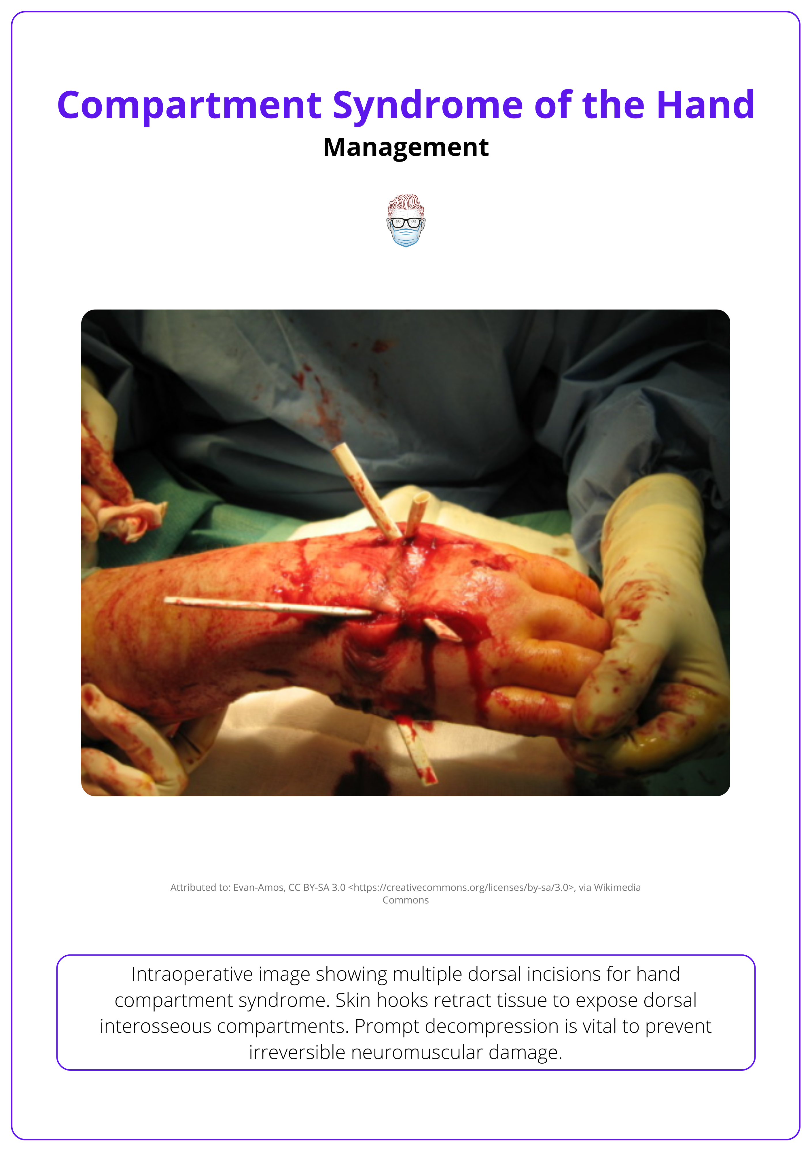 Intraoperative exposure of hand compartments