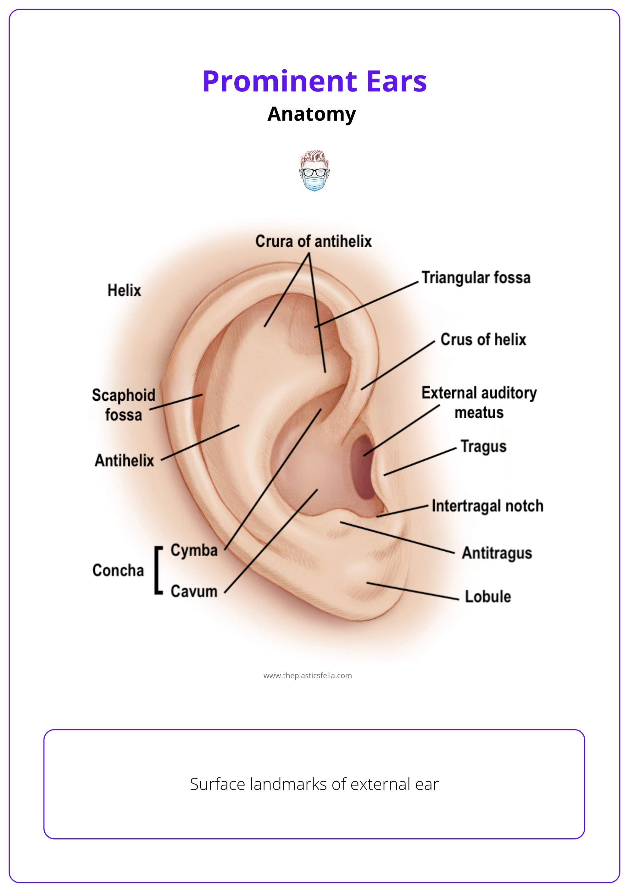 Key auricular landmarks, Otoplasty, Prominent Ear