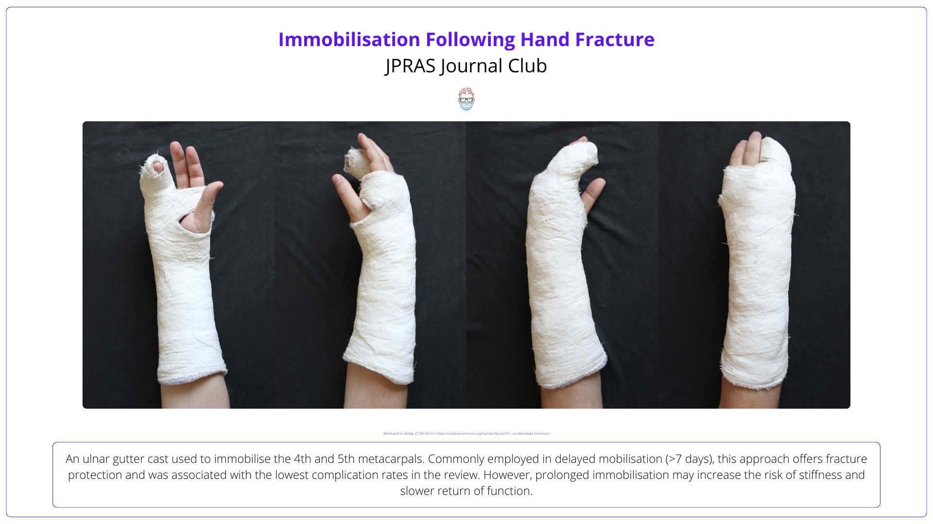 Mobilisation after open reduction and internal fixation of hand fractures