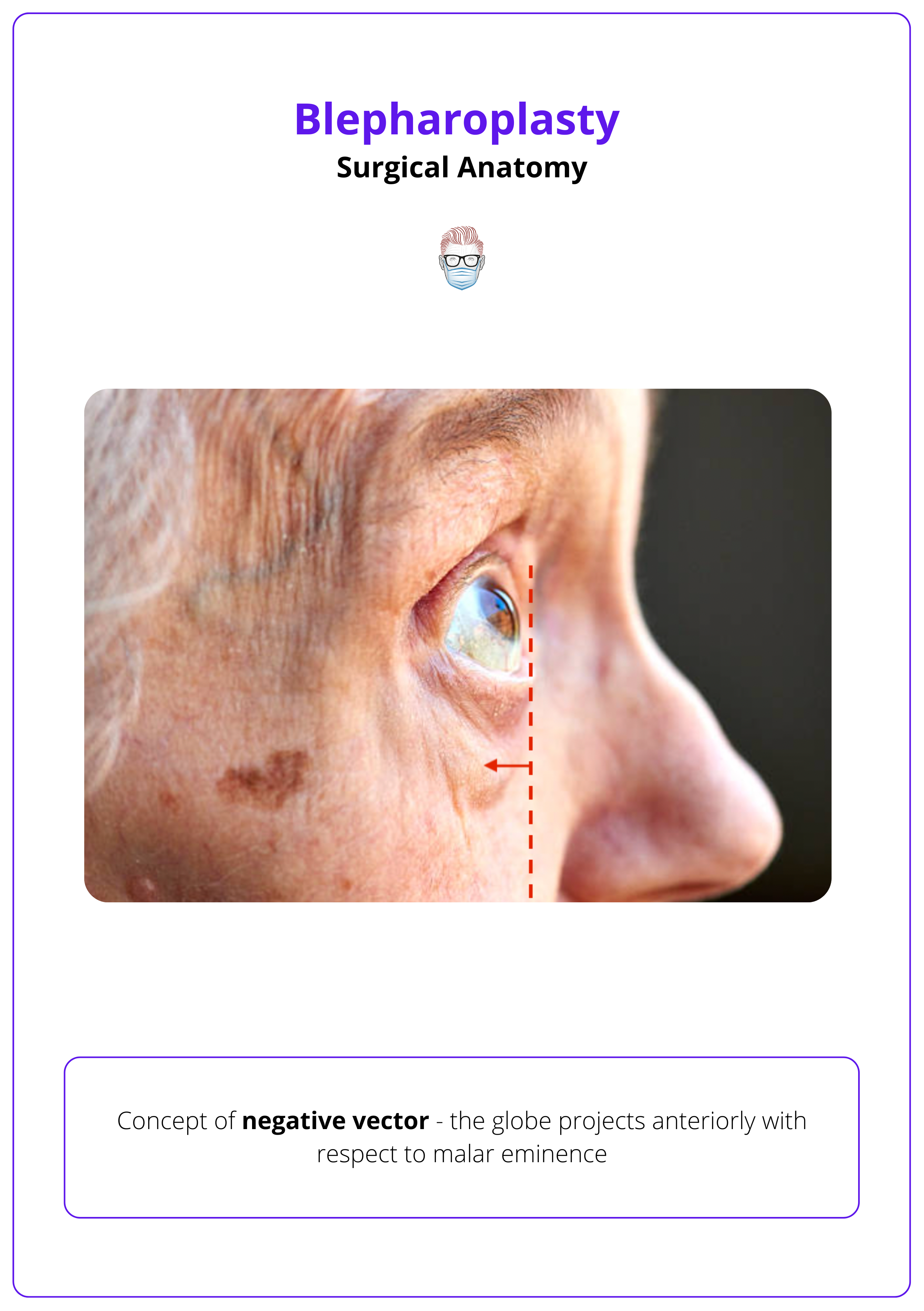 Negative vector, Surgical Anatomy for Blepharoplasty