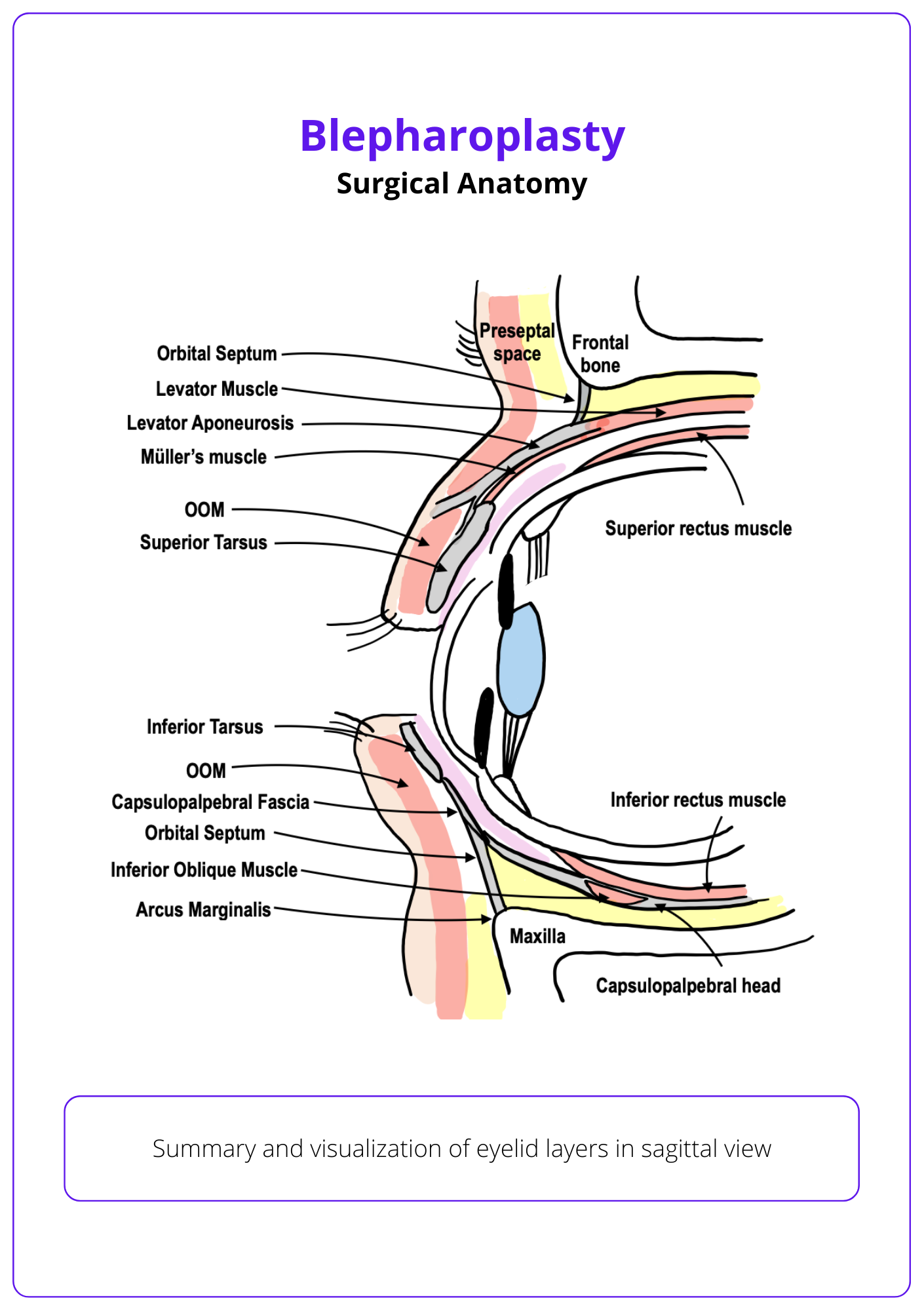 Layers of the eyelid in sagittal view, blepharoplasty