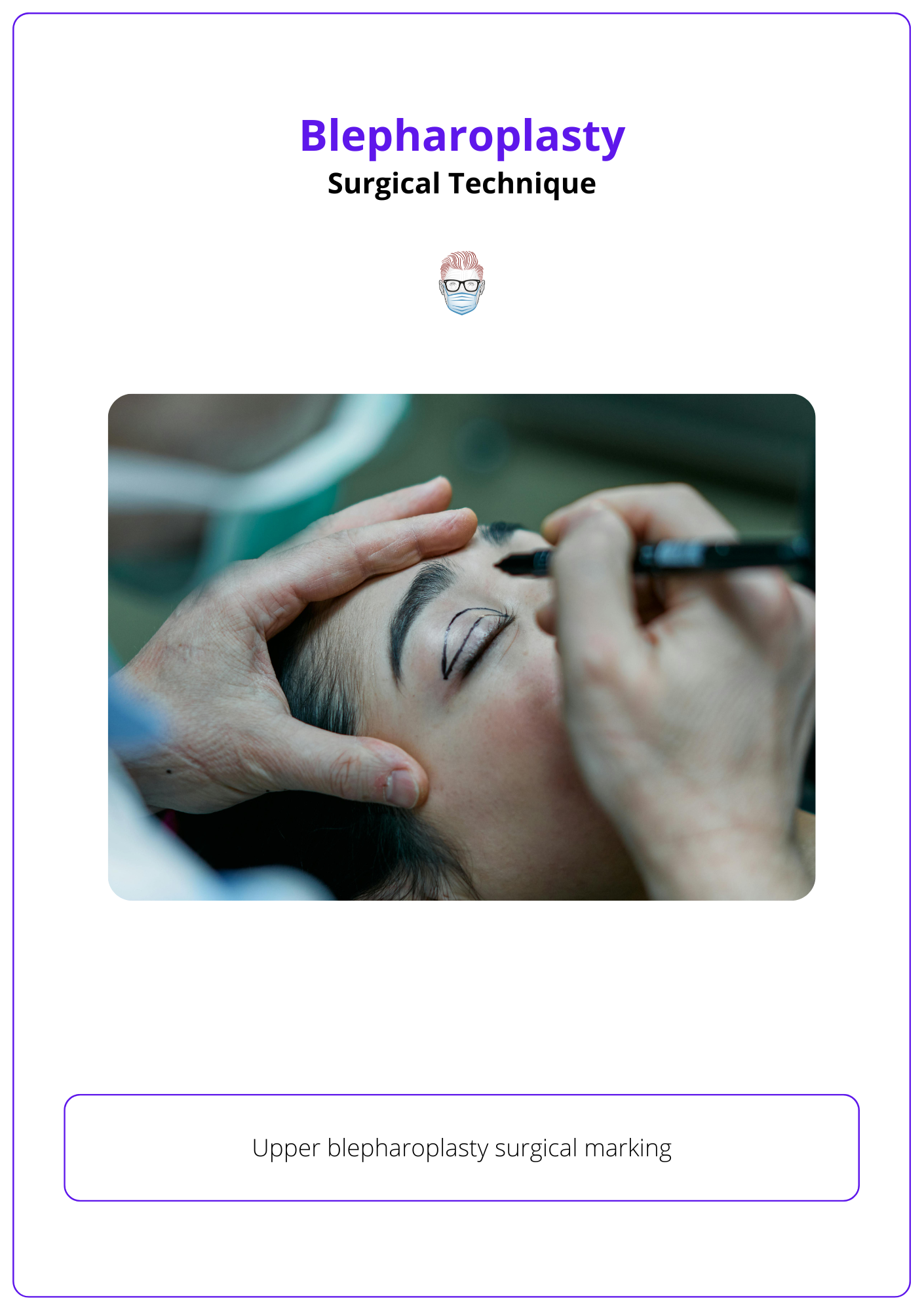 Upper blepharoplasty surgical marking