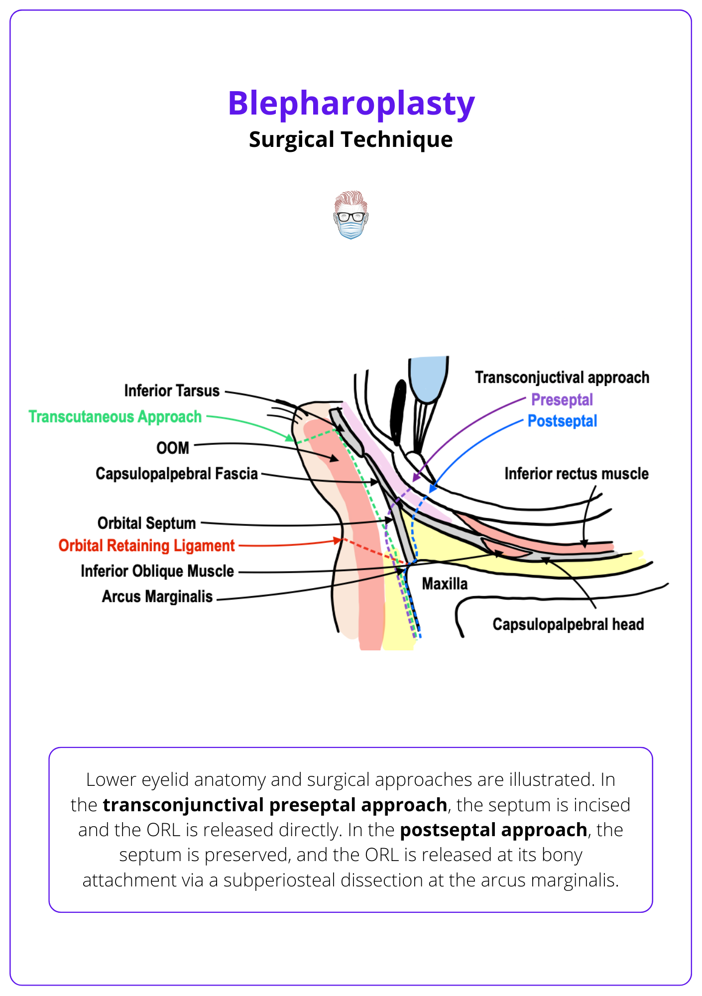 Lower eyelid anatomy and surgical approaches