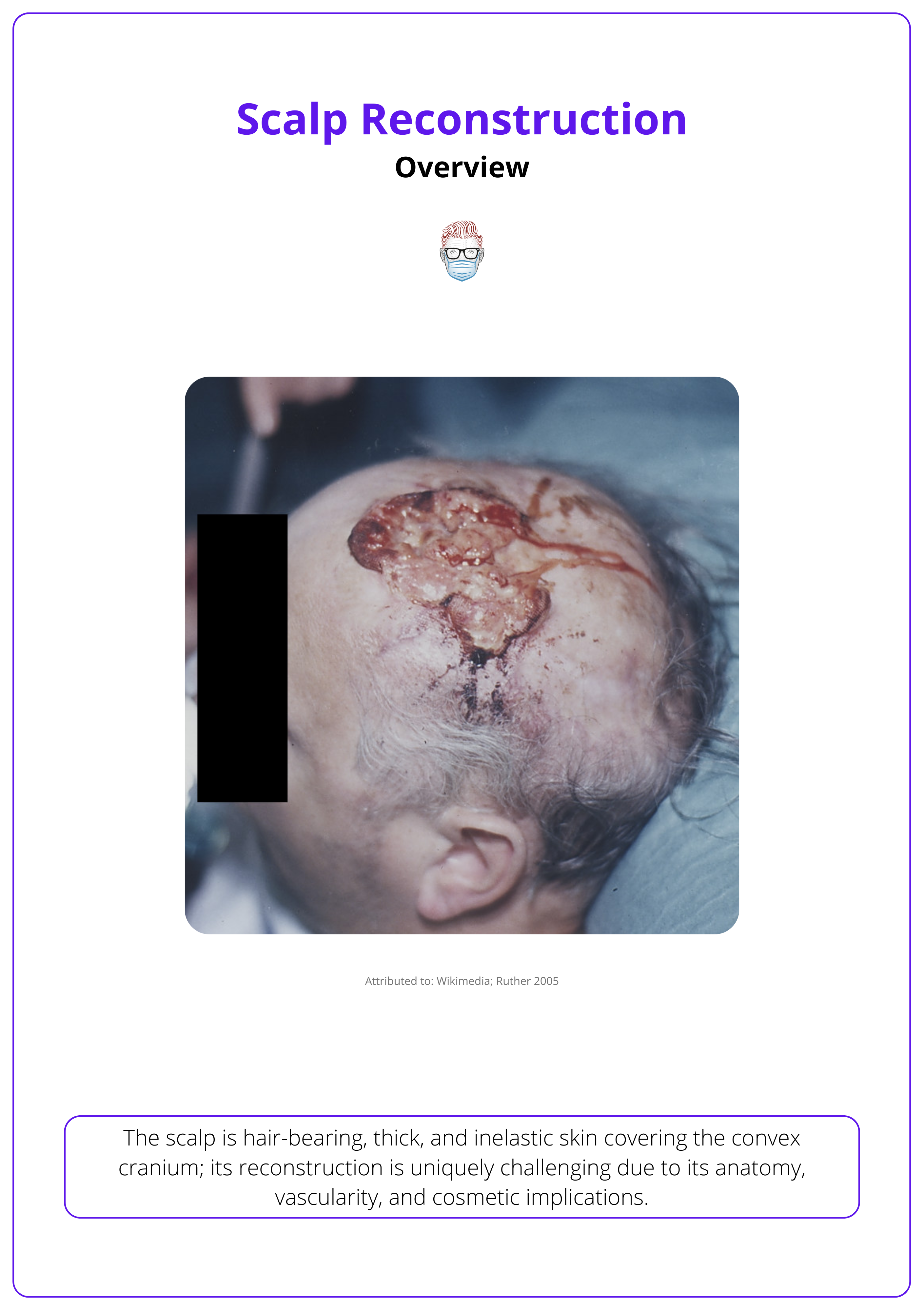 Scalp reconstruction