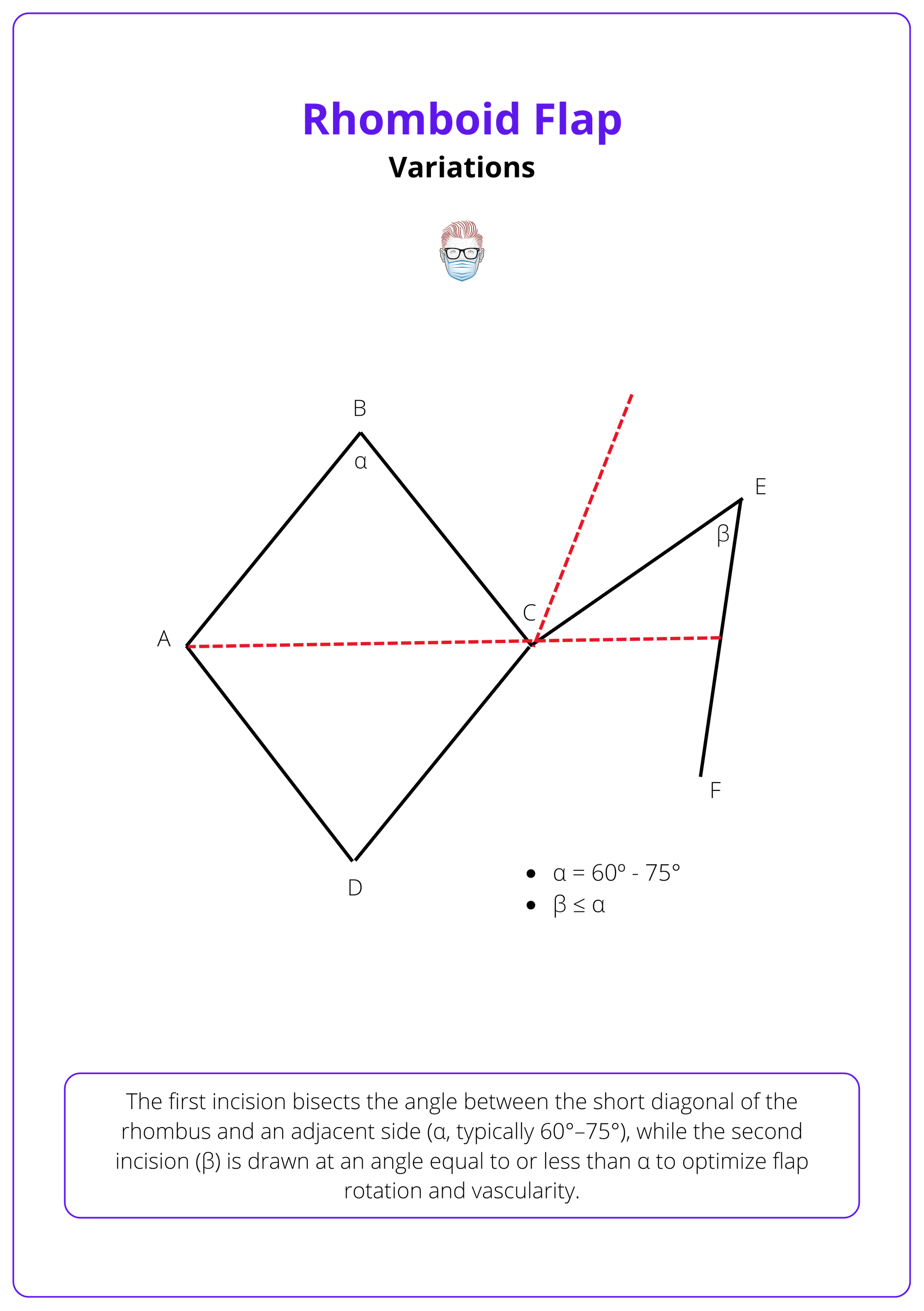 Dufourmental rhombic flap