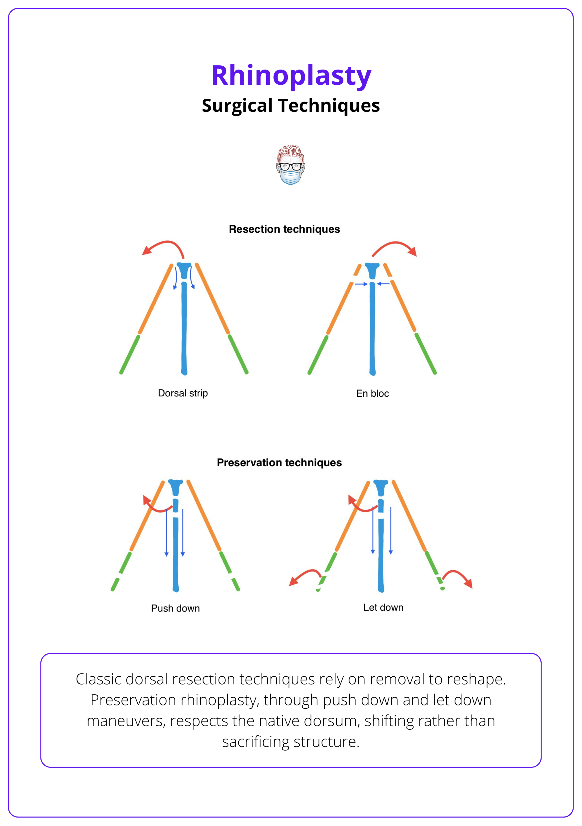 Dorsal resection techniques