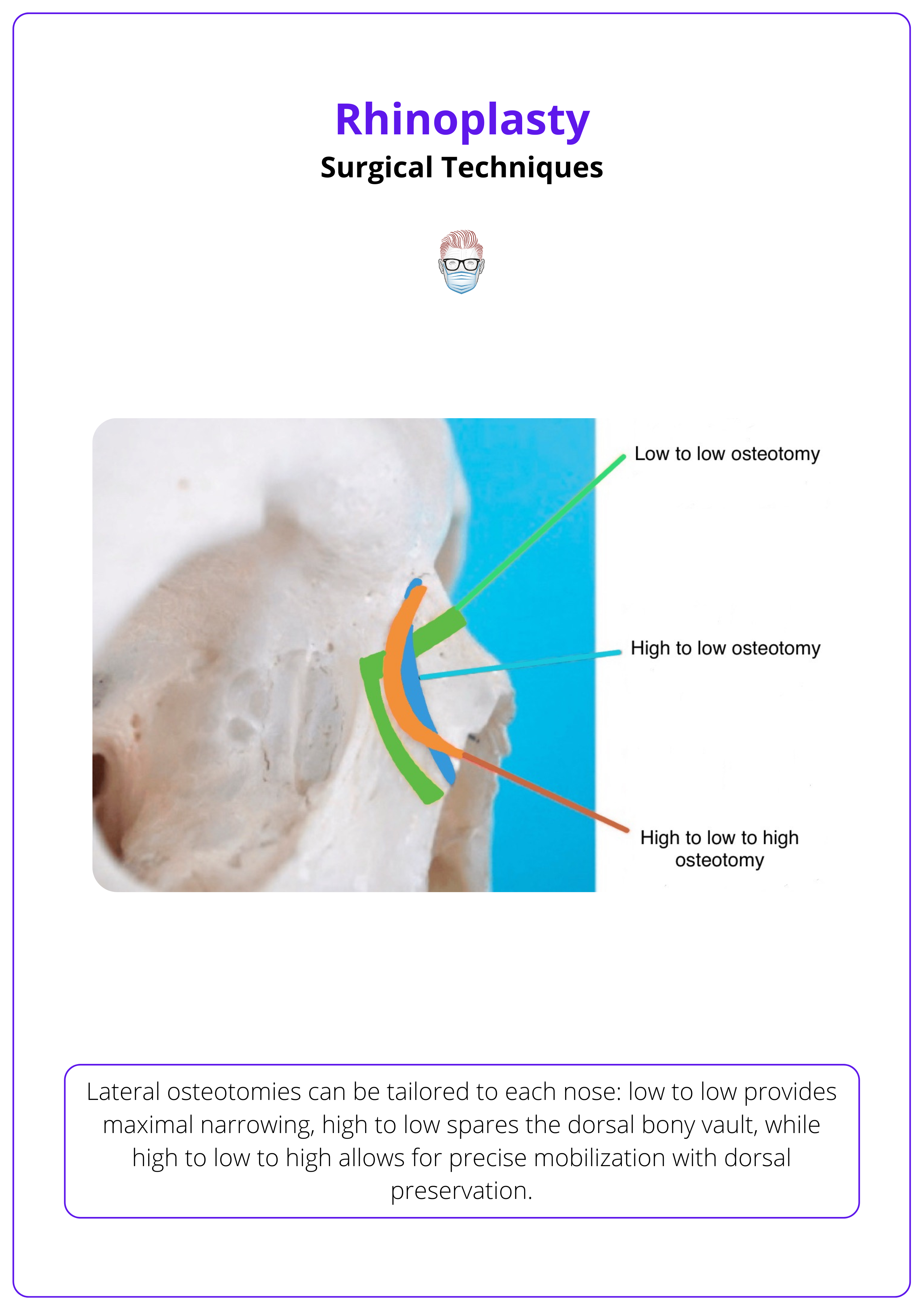 Lateral osteotomy technique