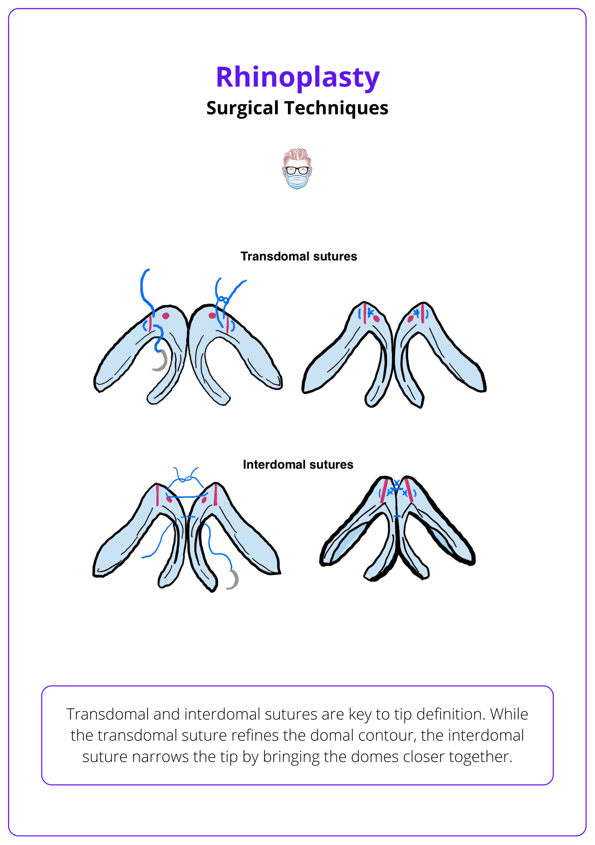 Transdomal and interdomal sutures