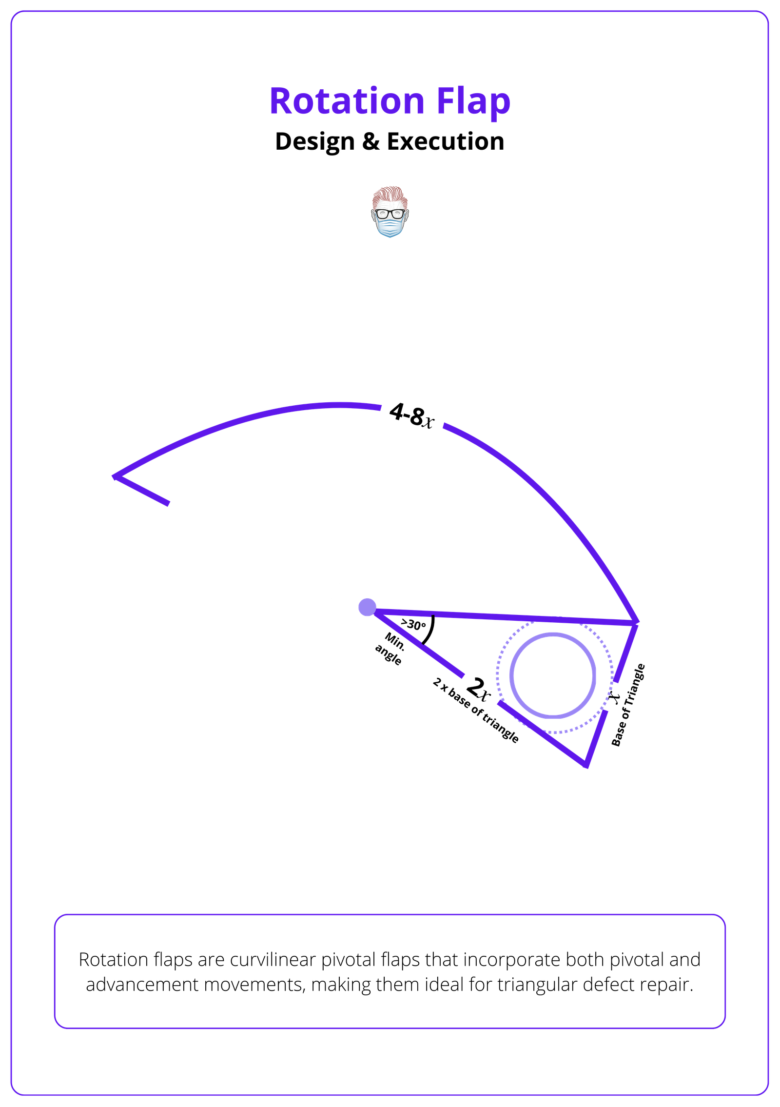 Rotation Flap: Identifying the Pivot Point