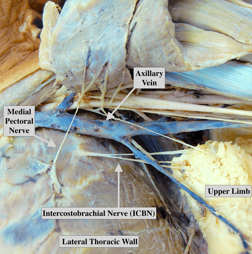 The Intercostobrachial Nerve During Axillary Dissection