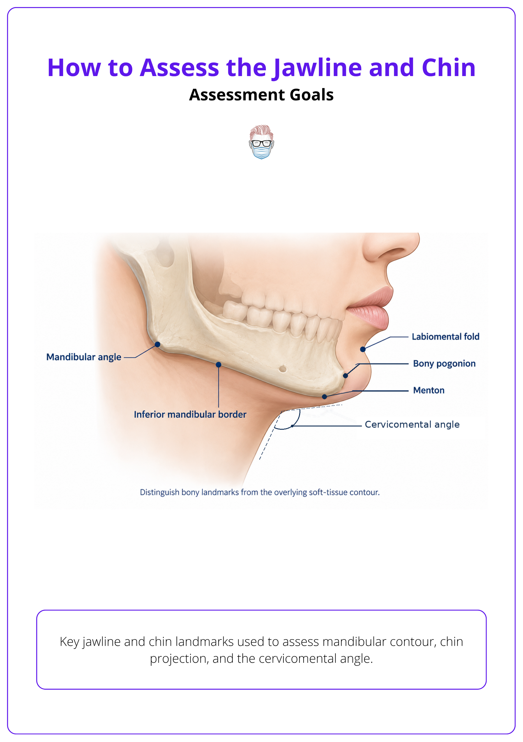 Key jawline and chin landmarks used to assess mandibular contour, chin projection, and the cervicomental angle.