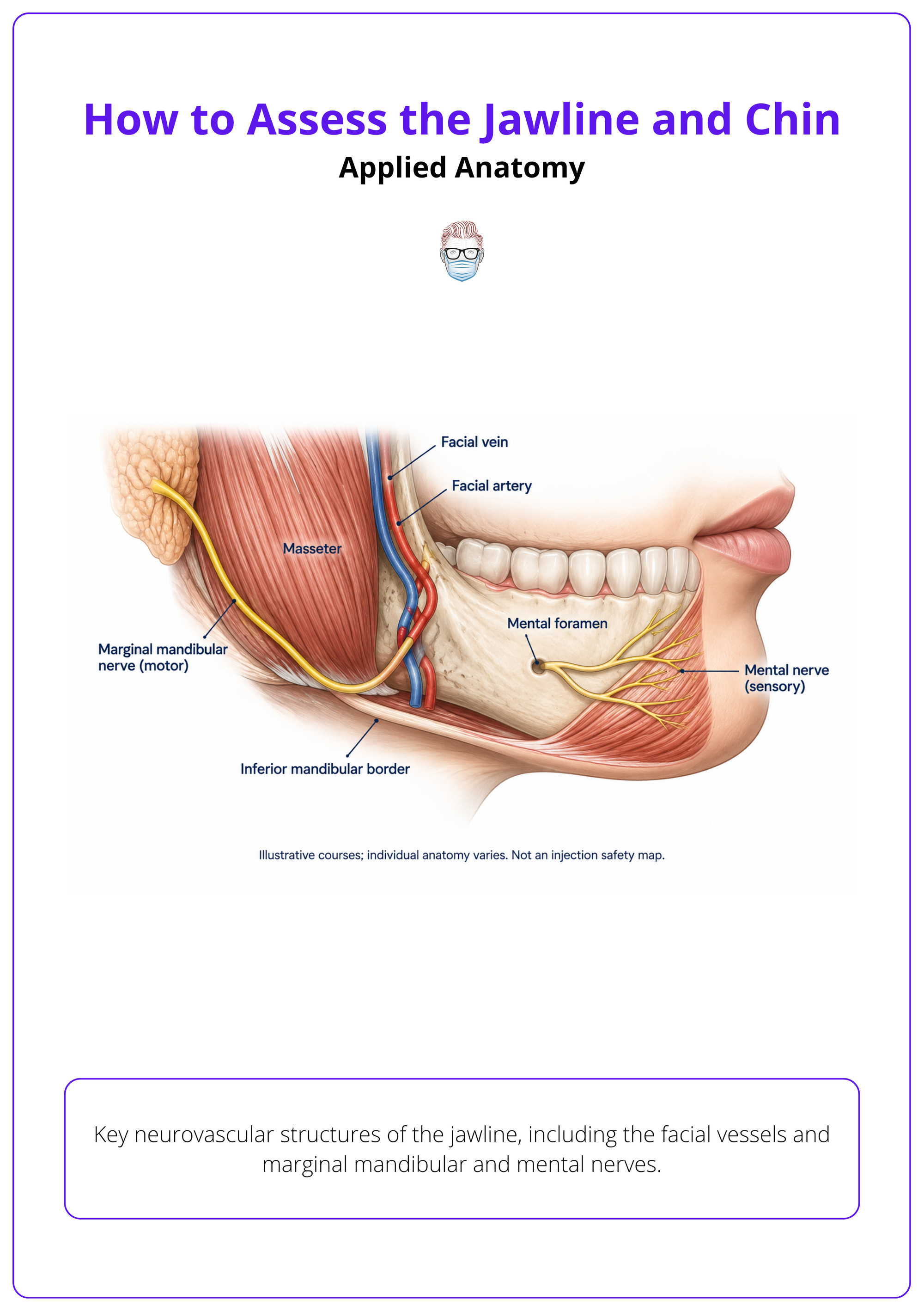 Key neurovascular structures of the jawline, including the facial vessels and marginal mandibular and mental nerves.