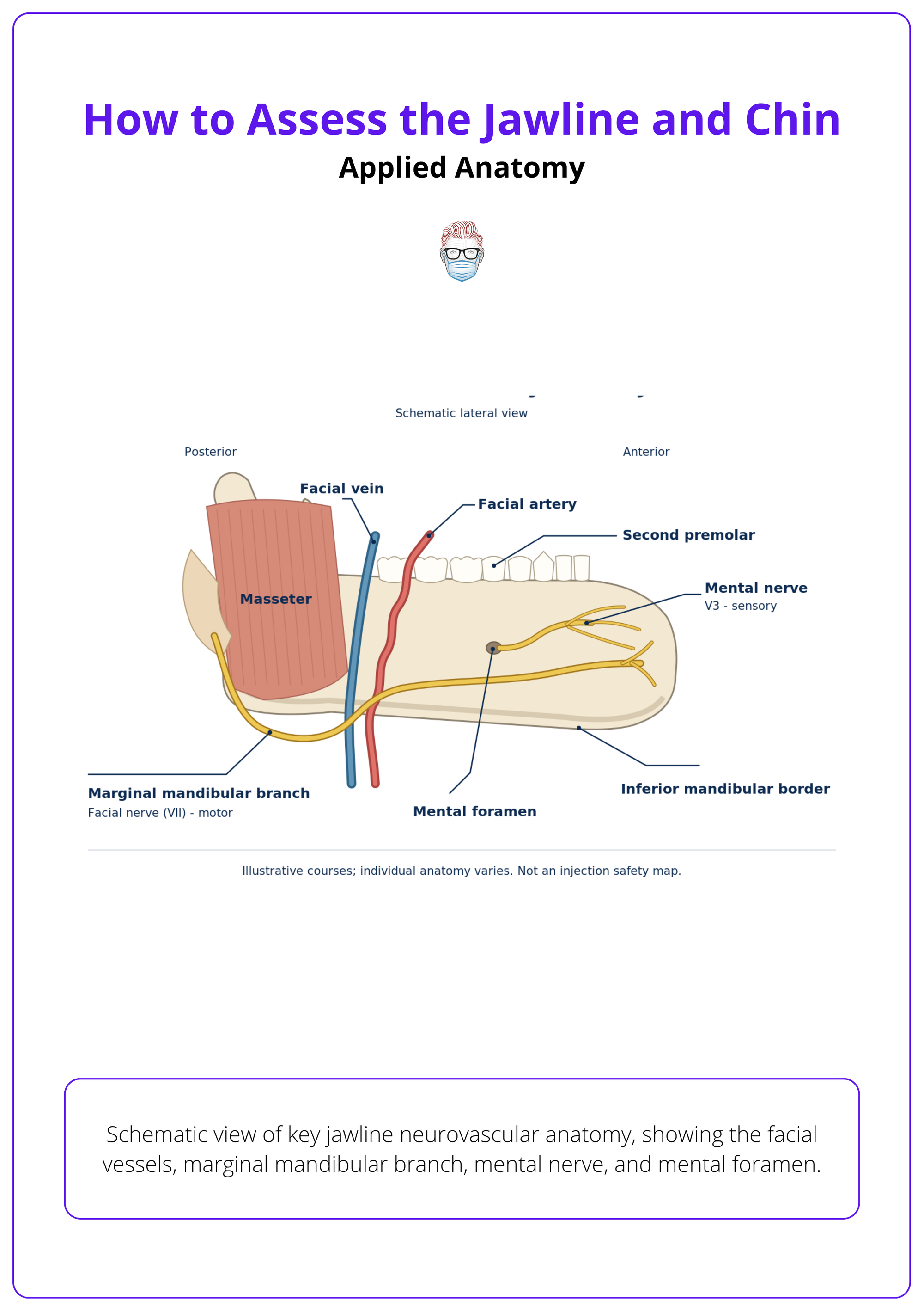 Schematic view of key jawline neurovascular anatomy, showing the facial vessels, marginal mandibular branch, mental nerve, and mental foramen.