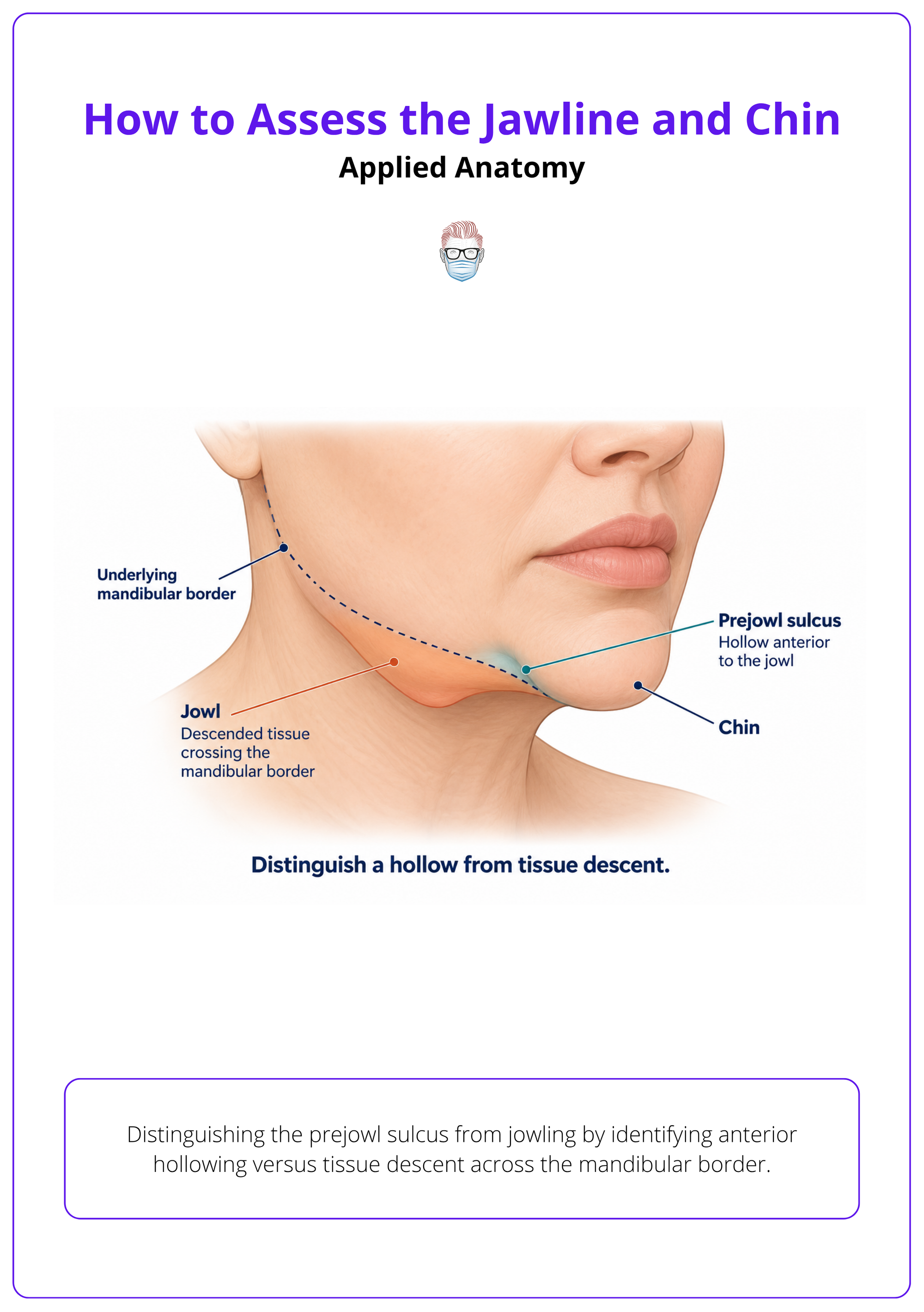 Distinguishing the prejowl sulcus from jowling by identifying anterior hollowing versus tissue descent across the mandibular border.