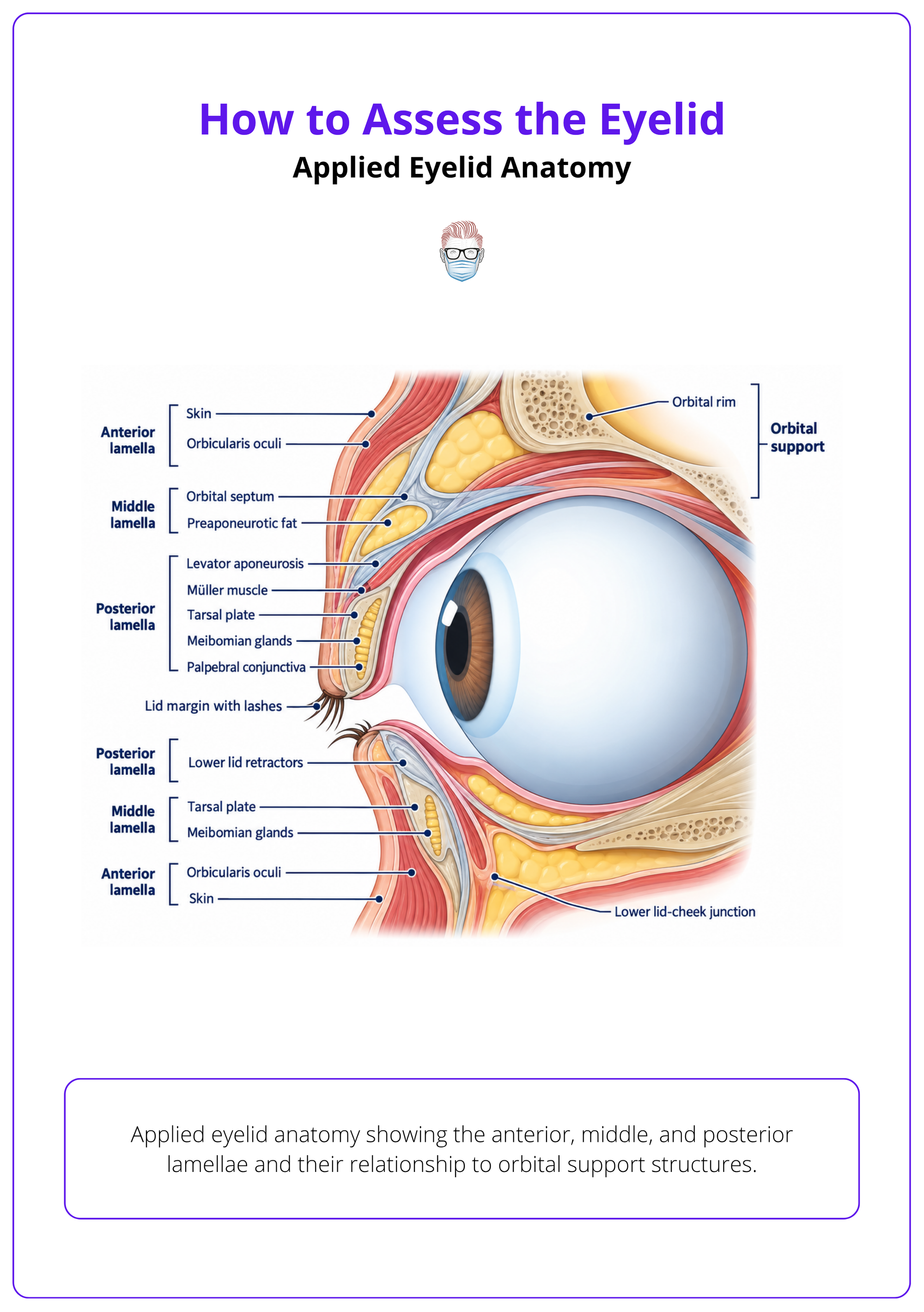 Applied eyelid anatomy showing the anterior, middle, and posterior lamellae and their relationship to orbital support structures.